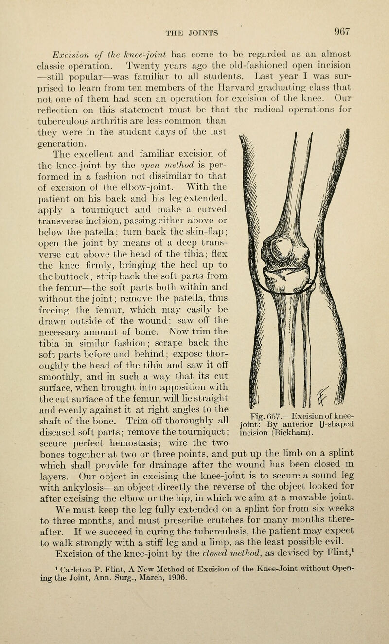 Excision of the knee-joint has come to be regarded as an almost classic operation. Twenty years ago the old-fashioned open incision —still popular—was familiar to all students. Last year I was sur- prised to learn from ten members of the Harvard graduating class that not one of them had seen an operation for excision of the knee. Our reflection on this statement must be that the radical operations for tuberculous arthritis are less common than they were in the student days of the last generation. The excellent and familiar excision of the knee-joint by the open method is per- formed in a fashion not dissimilar to that of excision of the elbow-joint. With the patient on his back and his leg extended, apply a tourniquet and make a curved transverse incision, passing either above or below the patella; turn back the skin-flap; open the joint by means of a deep trans- verse cut above the head of the tibia; flex the knee firmly, bringing the heel up to the buttock; strip back the soft parts from the femur—the soft parts both within and without the joint; remove the patella, thus freeing the femur, which may easil}'' be drav^^l outside of the wound; saw off the necessary amount of bone. Now trim the tibia in similar fashion; scrape back the soft parts before and behind; expose thor- oughly the head of the tibia and saw it off smoothly, and in such a way that its cut surface, when brought into apposition with the cut surface of the femur, will lie straight and evenly against it at right angles to the shaft of the bone. Trim off thoroughly all diseased soft parts; remove the tourniquet; secure perfect hemostasis; wire the two bones together at two or three points, and put up the limb on a splint which shall provide for drainage after the wound has been closed in layers. Our object in excising the knee-joint is to secure a sound leg with ankylosis—an object directly the reverse of the object looked for after excising the elbow or the hip, in which we aim at a movable joint. We must keep the leg fully extended on a splint for from six weeks to three months, and must prescribe crutches for many months there- after. If we succeed in curing the tuberculosis, the patient may expect to walk strongly with a stiff leg and a Hmp, as the least possible evil. Excision of the knee-joint by the closed method, as devised by Flint/ 1 Carleton P. Flint, A New Method of Excision of the Knee-Joint without Open- ing the Joint, Ann. Surg., March, 1906. Fig. 657.^—Excision of knee- joint: By anterior U-shaped incision (Bickham).