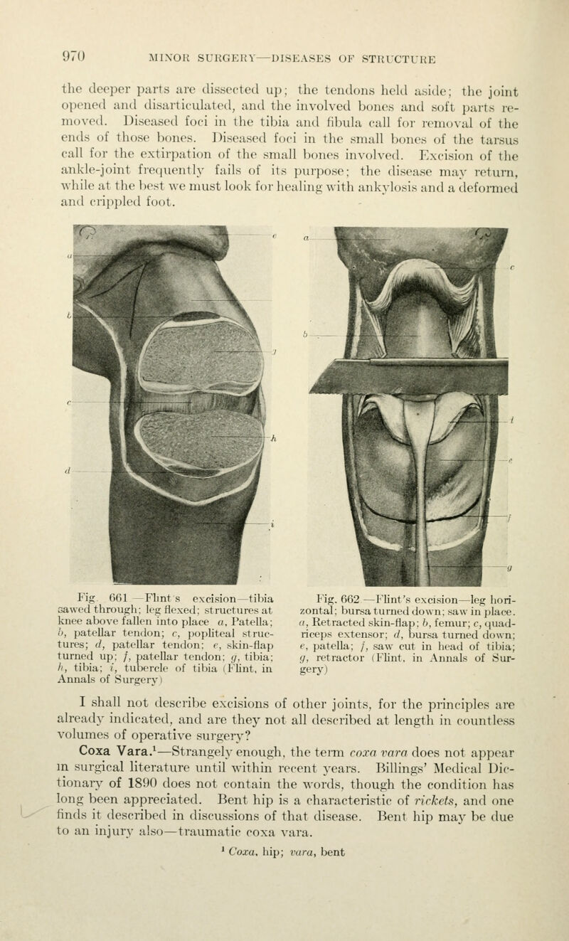 the deeper parts are dissected u\>\ the tendons held aside; the joint opened and disarticulated, and the involved bones and soft parts re- moved. Diseased foci in the tibia and fibula call for remcn-al of the ends of those bones. Diseased foci in the small bones of the tarsus call for the extirpation of the small bones involved. Excision of the ankle-joint frequently fails of its purpose; the disease may retui-n, while at the best we must look for healing with ankylosis and a deformed and crippled foot. Fig, 661 — Flint s excision—tibia cawed through; leg flexed; structures at knee above fallen into place a, Patella; h, patellar tendon; r, popliteal struc- tures; d, patellar tendon; e, skin-flap turned up; /, patellar tendon; g, tibia; /', tibia; /, tubercle of tibia (Flint, in Annals of Surgery i Fig, 662—Flint's excision—leg hori- zontal; bursa turned down; saw in })lace. a, Retracted skin-fiap; 6, femur; c, (juad- riceps extensor; (/, l5ur.sa turned down; (', patella; /, saw cut in head of tibia; y, retractor (Flint, in Annals of Sur- gery) I shall not describe excisions of other joints, for the principles are already indicated, and are they not all described at length in countless volumes of operative surgery? Coxa Vara.*—Strangely enough, the term coxa vara does not appear m surgical literature until within recent years. Billings' Medical Dic- tionary^ of 1890 does not contain the words, though the condition has long been appreciated. Bent hip is a characteristic of rickets, and one finds it described in discussions of that disease. Bent hip may be due to an injury also—traumatic coxa vara. ' Coxa, hip; vara, bent