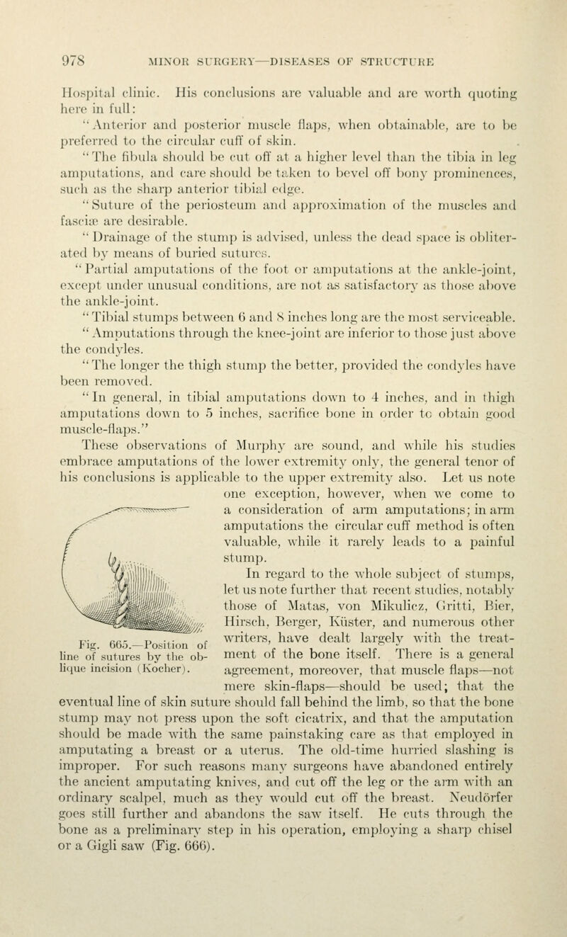 Hospital clinic. His conclusions are valuable and are worth quoting here in full: ''Anterior and posterior muscle flaps, when obtainable, are to be preferred to the circular cuff of skin.  The fibula should be cut off at a higher level than the tibia in leg amputations, and care should be taken to bevel off bony prominences, such as the sharp anterior tibial edge. Suture of the i^eriosteum and approximation of tlie mu.scles and fasciie are desirable.  Drainage of the stump is advised, unless the dead space is obliter- ated by means of buried sutures.  Partial amputations of the foot or amputations at the ankle-joint, except under unusual conditions, are not as satisfactory as those above the ankle-joint.  Tibial stumps between 6 and S inches long are the most serviceable. Amputations through the knee-joint are inferior to those just above the condyles. The longer the thigh stump the better, jjrovided the condyles have been removed.  In general, in tibial amputations down to 4 inches, and in thigh amputations down to 5 inches, sacrifice bone in order tc obtain good muscle-flaps. These observations of Mui'phy are sound, and while his studies embrace amputations of the lower extremity only, the general tenor of his conclusions is applicable to the upper extremity also. Let us note one exception, however, when we come to a consideration of arm amputations; in arm amputations the circular cuff method is often valuable, while it rarely leads to a painful stump. In regard to the whole subject of stumps, let us note further that recent studies, notably those of Matas, von Mikulicz, Gritti, Bier, ■oy,, Hirsch, Berger, Kiister, and numerous other FV cc—P -'i' f writers, have dealt largely with the treat- Une oTsutures by the ob- ment of the bone itself. There is a general lique incision (Kocher). agreement, moreover, that muscle flaps—^not mere skin-flaps—should be used; that the eventual line of skin suture should fall behind the limb, so that the bone stumi? may not press upon the soft cicatrix, and that the amputation should be made w'ith the same painstaking care as that employed in amputating a breast or a uterus. The old-time hurried slashing is improper. For such reasons many surgeons have abandoned entirely the ancient amputating knives, and cut ofi the leg or the arm with an ordinary scalpel, much as they would cut off the breast. Neudorfer goes still further and abandons the saw itself. He cuts through the bone as a preliminary step in his operation, employing a sharp chisel or a Gigli saw (Fig. 666).