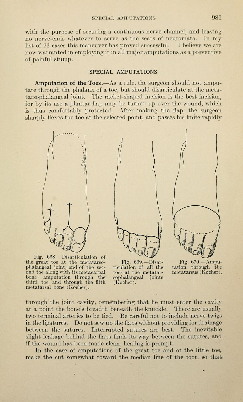 with the purpose of securing a continuous nei-ve channel, and leaving no nerve-ends whatever to serve as the seats of neuromata. In my list of 23 cases this maneuver has proved successful. I believe we are now warranted in employing it in all major amputations as a preventive of painful stump. SPECIAL AMPUTATIONS Amputation of the Toes.—As a rule, the surgeon should not ampu- tate through the phalanx of a toe, but should disarticulate at the meta- tarsophalangeal joint. The racket-shaped incision is the best incision, for by its use a plantar flap may be turned up over the wound, which is thus comfortably protected. After making the flap, the surgeon sharply flexes the toe at the selected point, and passes his knife rapidly Fig. 668.—Disarticulation of the great toe at the metatarso- phalangeal joint, and of the sec- ond toe along with its metacarpal bone: amputation through the third toe and through the fifth metatarsal bone (Kocher). Fig. 669.—Disar- ticulation of all the toes at the metatar- sophalangeal joints (Kocher). Fig. 670.—Ampu- tation through the metatarsus (Kocher). through the joint cavity, remembering that he must enter the cavity at a point the bone's breadth beneath the knuckle. There are usually two terminal arteries to be tied. Be careful not to include nerve twigs in the ligatures. Do not sew up the flaps without providing for drainage between the sutures. Interrupted sutures are best. The inevitable slight leakage behind the flaps finds its way between the sutures, and if the wound has been made clean, healing is prompt. In the case of amputations of the great toe and of the little toe, make the cut somewhat toward the median line of the foot, so that