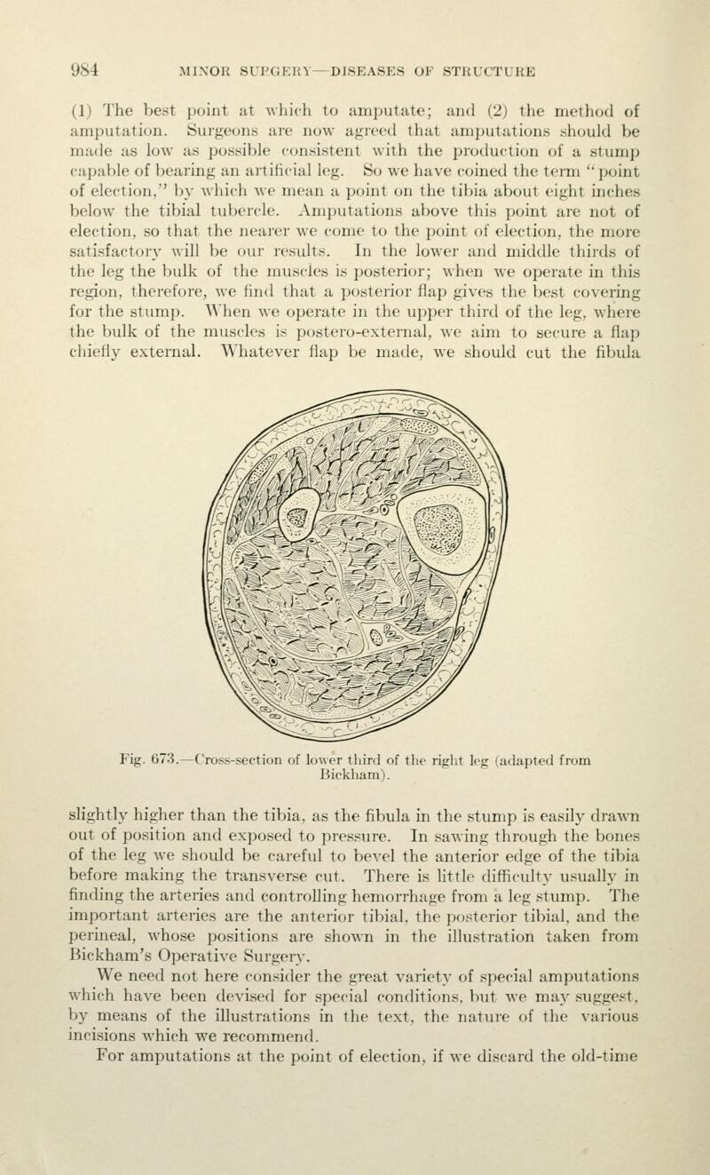 (1) The best point at -which to amputate; and (2) the method of amputation. Surgeons are now agreed that amputations should be made as low as possible consistent with the production of a stump capable of bearing an artificial leg. So we have coined the term point of election, by which we mean a point on the tibia about eight inches below the tibial tubercle. Amputations above this point are not of election, so that the nearer we come to the point of election, the more satisfactoiy will be our results. In the lower and middle thiids of the leg the bulk of the muscles is posterior; when we operate in this region, therefore, we find that a posterior flap gives the best covering for the stump. ^^ hen we operate in the upper third of the leg, where the bulk of the muscles is postero-external, we aim to secure a flap chiefly external. Whatever flap be made, we should cut the fibula Fig. 673.—Cross-section of lower third of the right leg (adapted from Bickham). slightly higher than the tibia, as the fibula in the stump is easily drawn out of position and exposed to pressure. In sawing through the bones of the leg we should be careful to bevel the anterior edge of the tibia before making the transverse cut. There is little difficulty usually in finding the arteries and controlling hemorrhage from a leg stump. The important arteries are the anterior tibial, the posterior tibial, and the perineal, whose positions are shown in the illustration taken from Bickham's Operative Surgery. We need not here consider the great variety of .special amputations which have been devised for special conditions, but we may suggest, by means of the illustrations in the text, the nature of the various incisions which we recommend. For amputations at the point of election, if we discard the old-time