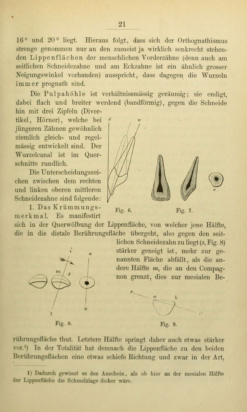 16 und 20'^ lie^t. Hieraus folgt, dass sich der Orthognathismus strenge genommen nur an den zumeist ja wirklich senkrecht stehen- den Lippen flächen der menschlichen Yorderzähne (denn auch am seitlichen Schneidezahne und am Eckzahne ist ein ähnlich grosser Neigungswinkel vorhanden) ausspricht, dass dagegen die Wurzeln immer prognath sind. Die Pulpahöhie ist verhältnissmässig geräumig; sie endigt, dabei flach und breiter werdend (bandförmig), gegen die Schneide hin mit drei Zipfeln (Diver- tikel, Hörner), welche bei jüngeren Zähnen gewöhnlich ziemlich gleich- und regel- mässig entwickelt sind. Der Wurzelcanal ist im Quer- schnitte rundlich. Die Unterscheidungszei- chen zwischen dem rechten und linken oberen mittleren Schneidezahne sind folgende: 1. Das Krümmungs- merkmal. Es manifestirt sich in der Querwölbung der Lippenfläche, von welcher jene Hälfte, die in die distale Berührungsfläche übergeht, also gegen den seit- lichen Schneidezahn zu liegt (s, Fig. 8) i ^ stärker geneigt ist, mehr zur ge- nannten Fläche abfällt, als die an- dere Hälfte m, die an den Compag- non grenzt, dies zur mesialen Be- Fig. 6. Fig. 7. Fig. 8. Fig. 9. rührungsflächo thut. Letztere Hälfte springt daher auch etwas stärker vor.') In der Totalität hat demnach die Lippenfläche zu den beiden Hfrühningsflächon eine etwas schiefe Richtung und zwar in der Art, 1) Dadurch gowinnt os don AnschRin, als ob liior an dor mesialen Hälfte der Lippenflächo die Schmelzlago dicker wäre.