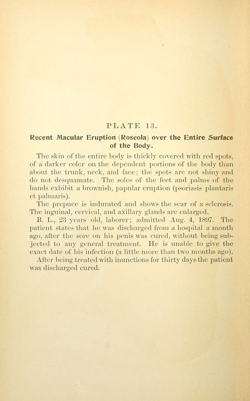 Recent Macular Eruption (Roseola) over the Entire Surface of the Body. The skin of the entire body is thickly covered with red spots, of a darker color on the dependent portions of the body than about the trunk, neck, and face; the spots are not shiny and do not desquamate. The soles of the feet and palms of the hands exhibit a brownish, papular eruption (psoriasis plantaris et palmaris). The prepuce is indurated and sliows the scar of a sclerosis. The inguinal, cervical, and axillary glands are enlarged. B. L., 23 years old, laborer; admitted Aug. 4, 1897. The patient states that he was discharged from a hospital a month ago, after the sore on his penis was cured, without being sub- jected to any general treatment. He is unable to give the exact date of his infection (a little more than two months ago). After being treated with inunctions for thirty days the patient was discharged cured.