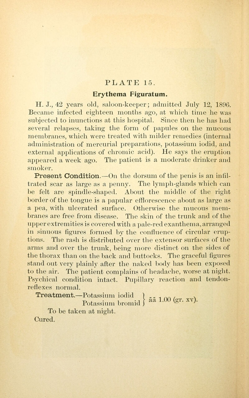 Erythema Figuratum. H. J,, 42 years old, saloon-keeper; admitted July 12, 189G. Became infected eighteen months ago, at which time he was subjected to inunctions at this hosioital. Since then he has had several relapses, taking the form of pajDules on the mucous membranes, which were treated with milder remedies (internal administration of mercurial preparations, potassium iodid, and external applications of chromic acid). He says the eruption appeared a week ago. The patient is a moderate drinker and smoker. Present Condition.^On the dorsum of the penis is an infil- trated scar as large as a penny. The lymph-glands which can be felt are spindle-shaped. About the middle of the right border of the tongue is a papular efflorescence about as large as a pea, with ulcerated surface. Otherwise the mucous mem- branes are free from disease. The skin of the trunk and of the upper extremities is covered with a pale-red exanthema, arranged in sinuous figures formed by the confluence of circular erup- tions. The rash is distributed over the extensor surfaces of the arms and over the trunk, being more distinct on the sides of the thorax than on the back and buttocks. The graceful figures stand out very plainly after the naked body has been exposed to the air. The patient complains of headache, w^orse at night. Psychical condition intact. Pupillary reaction and tendon- reflexes normal. Treatment.—Potassium iodid I - - i on ^o- - ^ Potassium bromid j • V& • ;• To be taken at night. Cured.