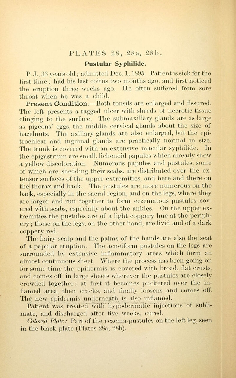 PLATES 28, 28a, 28b. Pustular Syphilide. P. J., 33 years old ; admitted Dec. 1,1895. Patient is sick for the first time; had his last coitus two months ago, and first noticed the eruption three weeks ago. He often suffered from sore throat when he was a child. Present Condition.—Both tonsils are enlarged and fissured. The left presents a ragged ulcer with shreds of necrotic tissue clinging to the surface. The submaxillary glands are as large as pigeons' eggs, the middle cervical glands about the size of hazelnuts. The axillary glands are also enlarged, but the epi- trochlear and inguinal glands are practically normal in size. The trunk is covered with an extensive macular Syphilide. In the epigastrium are small, lichenoid papules which already show a yellow discoloration. Numerous papules and pustules, some of which are shedding their scabs, are distributed over the ex- tensor surfaces of the upper extremities, and liere and there on the thorax and back. The pustules are more numerous on the back, especially in the sacral region, and on the legs, where they are larger and run together to form eczematous pustules cov- ered with scabs, especially about the ankles. On the upper ex- tremities the pustules are of a light coppery hue at the periph- ery ; those on the legs, on the other hand, are livid and of a dark coppery red. The hairy scalp and the palms of the hands are also the seat of a papular eruption. The acneiform pustules on the legs are surrounded by extensive inflammatory areas which form an alniost continuous sheet. Where the process has been going on for some time the epidermis is covered with broad, flat crusts, and comes off in large sheets wherever the pustules are closely crowded together: at first it becomes puckered over the in- flamed area, then cracks, and finally loosens and comes off. The new epidermis underneath is also inflamed. Patient was treated with hypodermatic injections of subli- mate, and discharged after five weeks, cured. Colored Plate: Part of the eczema-pustules on the left leg, seen in the black plate (Plates 28a, 28b).