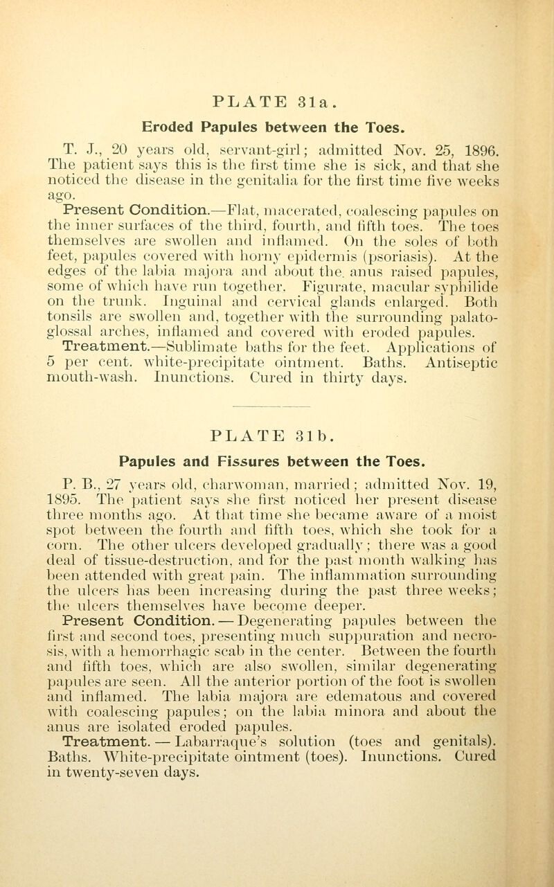 Eroded Papules between the Toes. T. J., 20 years old, .servant-girl; admitted Nov. 25, 1896. The patient says this is the first time she is sick, and that she noticed the disease in the genitalia for the first time five weeks ago. Present Condition.—Flat, macerated, coalescing papules on the inner surfaces of the third, fourth, and fifth toes. The toes themselves are swollen and inflamed. On the soles of both feet, papules covered with horny epidermis (psoriasis). At the edges of the labia majora and about the. anus raised j^apules, some of which have run together. Figurate, macular Syphilide on the trunk. Inguinal and cervical glands enlarged. Both tonsils are swollen and, together with the surrounding palato- glossal arches, inflamed and covered with eroded papules. Treatment.—Sublimate baths for the feet. Applications of 5 per cent, white-precipitate ointment. Baths. Antiseptic mouth-wash. Inunctions. Cured in thirty days. PLATE 81b. Papules and Fissures between the Toes. P. B., 27 years old, charwoman, married; admitted Nov. 19, 1895. The patient says she first noticed her present disease three months ago. At that time she became aware of a moist spot between the fourth and fifth toes, which she took for a corn. The other ulcers developed gradually ; there was a good deal of tissue-destruction, and for the past month walking has been attended with great pain. The inflammation surrounding the ulcers has been increasing during the past three weeks; the ulcers themselves have become deeper. Present Condition. — Degenerating papules betw^een the first and second toes, presenting much suppuration and necro- sis, with a hemorrhagic scab in the center. Betw^een the fourth and fifth toes, which are also swollen, similar degenerating papules are seen. All the anterior portion of the foot is swollen and inflamed. The labia majora are edematous and covered with coalescing papules; on the labia minora and about the anus are isolated eroded papules. Treatment. — Labarraque's solution (toes and genitals). Baths. White-precipitate ointment (toes). Inunctions. Cured in twenty-seven days.