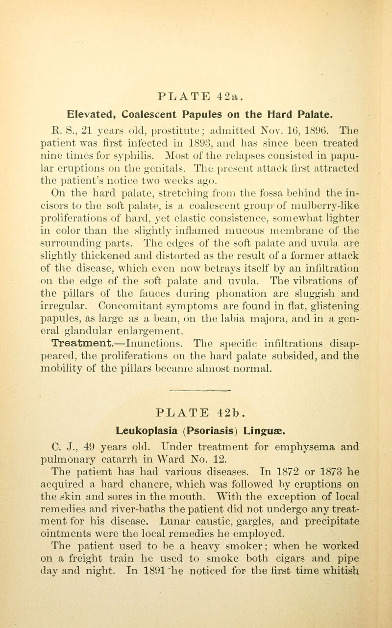 Elevated, Coalescent Papules on the Hard Palate. R. S., 21 years old, prostitute; admitted Nov. 10, lö96. The patient was first infected in 1893, and has since been treated nine times for syphihs. Most of the relapses consisted in papu- lar eruptions on the genitals. The present attack first attracted the patient's notice two weeks ago. On the hard palate, stretching from the fossa behind the in- cisors to the soft palate, is a coalescent group'of mulberry-like proliferations of hard, yet elastic consistence, somewhat lighter in color than the slightly inflamed mucous membrane of the surrounding parts. The edges of the soft palate and uvula are slightly thickened and distorted as the result of a former attack of the disease, which even now betrays itself by an infiltration on the edge of the soft palate and uvula. The vibrations of the pillars of the fauces during phonation are sluggish and irregular. Concomitant symptoms are found in flat, glistening papules, as large as a bean, on the labia majora, and in a gen- eral glandular enlargement. Treatment.—Inunctions. The specific infiltrations disap- peared, the proliferations on the hard palate subsided, and the mobility of the pillars became almost normal. PLATE 42b. Leukoplasia (Psoriasis) Linguae. C. J., 49 years old. Under treatment for emphysema and pulmonary catarrh in Ward No. 12. The patient has had various diseases. In 1872 or 1873 he acquired a hard chancre, which was followed by eruptions on the skin and sores in the mouth. With the exception of local remedies and river-baths the patient did not undergo any treat- ment for his disease. Lunar caustic, gargles, and precipitate ointments were the local remedies he employed. The patient used to be a heavy smoker; when he worked on a freight train he used to smoke both cigars and pipe day and night. In 1891 he noticed for the first time whitish