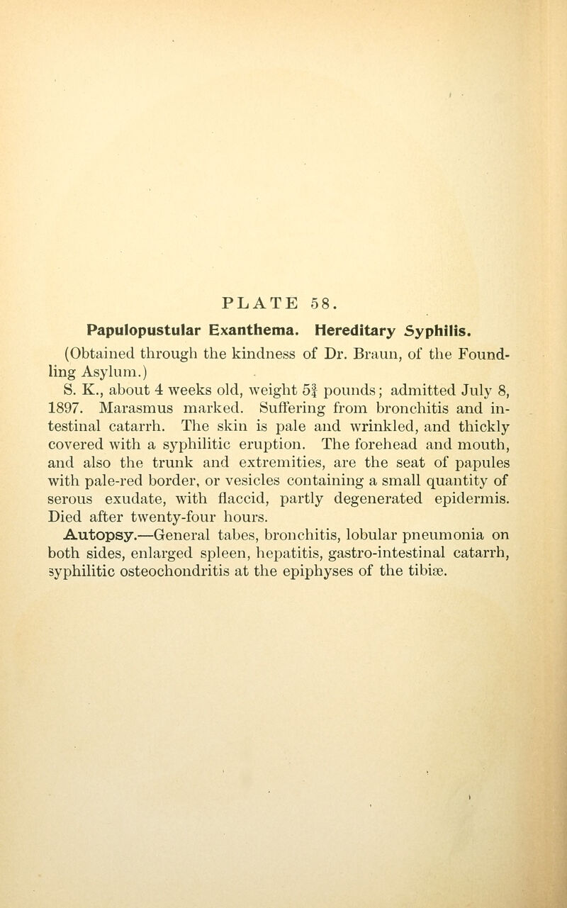 Papulopustular Exanthema. Hereditary Syphilis. (Obtained through the kindness of Dr. Braun, of the Found- ling Asyhini.) S. K., about 4 weeks old, weight 5| pounds; admitted July 8, 1897. Marasmus marked. Suffering from bronchitis and in- testinal catarrh. The skin is pale and wrinkled, and thickly covered with a syphilitic eruption. The forehead and mouth, and also the trunk and extremities, are the seat of papules with pale-red border, or vesicles containing a small quantity of serous exudate, with flaccid, partly degenerated epidermis. Died after twenty-four hours. Autopsy.—General tabes, bronchitis, lobular pneumonia on both sides, enlarged spleen, hepatitis, gastro-intestinal catarrh, syphilitic osteochondritis at the epiphyses of the tibiae.