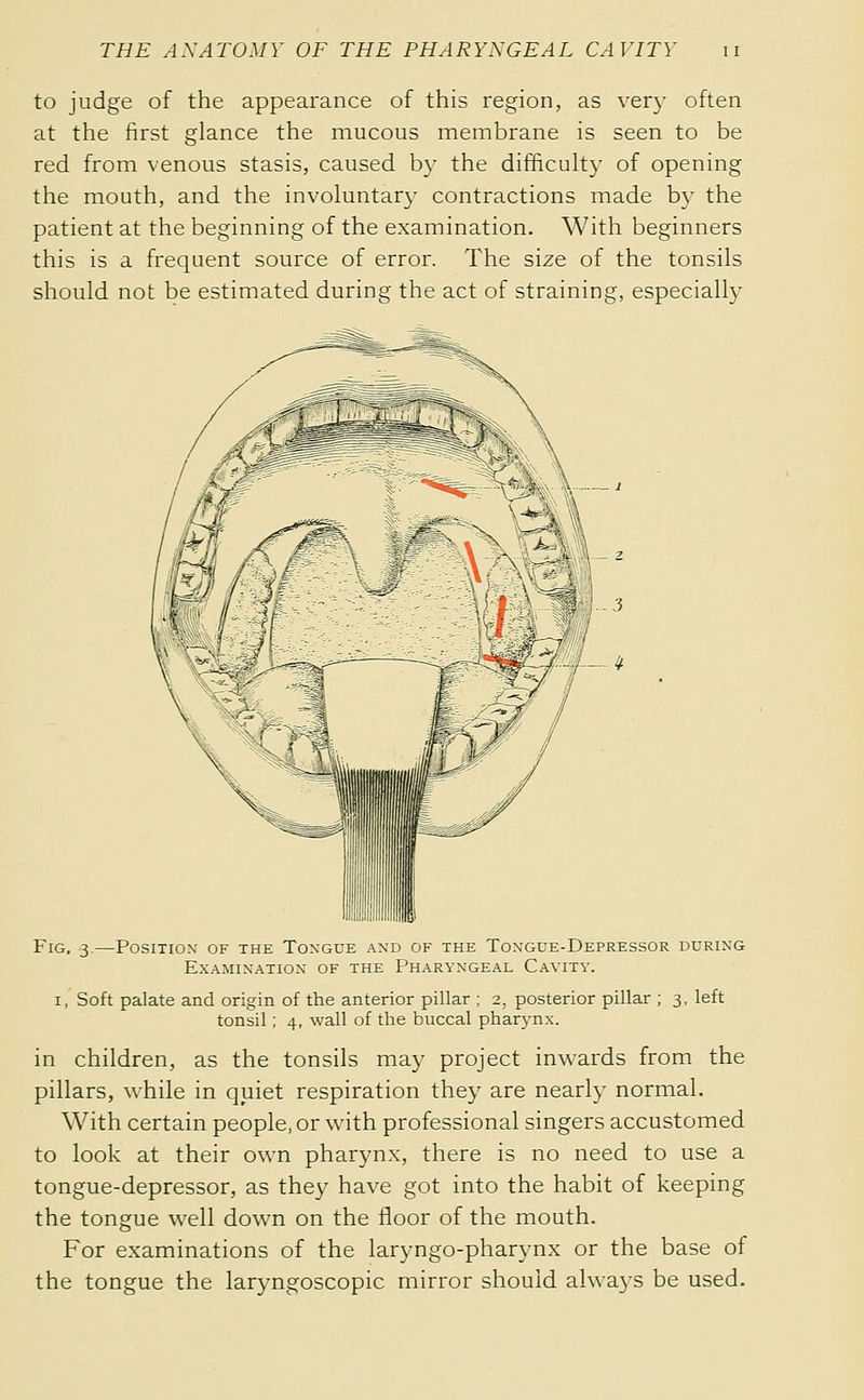 to judge of the appearance of this region, as very often at the first glance the mucous membrane is seen to be red from venous stasis, caused by the difficulty of opening the mouth, and the involuntar}- contractions made by the patient at the beginning of the examination. With beginners this is a frequent source of error. The size of the tonsils should not be estimated during the act of straining, especiall}- Fig, 3 -Position- of the Tongue and of the Tongue-Depressor during Examination of the Pharyngeal Cavity. I, Soft palate and origin of the anterior pillar ; 2. posterior pillar ; 3, left tonsil ; 4, wall of the buccal pharynx. in children, as the tonsils may project inwards from the pillars, while in quiet respiration they are nearly normal. With certain people, or with professional singers accustomed to look at their own pharynx, there is no need to use a tongue-depressor, as they have got into the habit of keeping the tongue well down on the floor of the mouth. For examinations of the laryngo-pharynx or the base of the tongue the laryngoscopic mirror should alwa3-s be used.