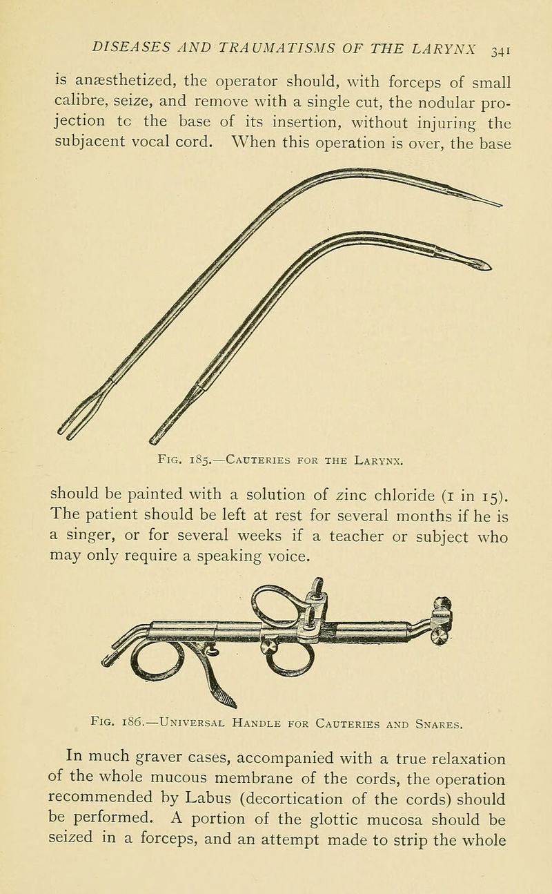 is anaesthetized, the operator should, with forceps of small calibre, seize, and remove with a single cut, the nodular pro- jection to the base of its insertion, without injuring the subjacent vocal cord. When this operation is over, the base Cauteries for the Larynx, should be painted with a solution of zinc chloride (i in 15). The patient should be left at rest for several months if he is a singer, or for several weeks if a teacher or subject who may only require a speaking voice. Fig. 1S6.—Universal Handle for Cauteries and Snares. In much graver cases, accompanied with a true relaxation of the whole mucous membrane of the cords, the operation recommended by Labus (decortication of the cords) should be performed. A portion of the glottic mucosa should be seized in a forceps, and an attempt made to strip the whole