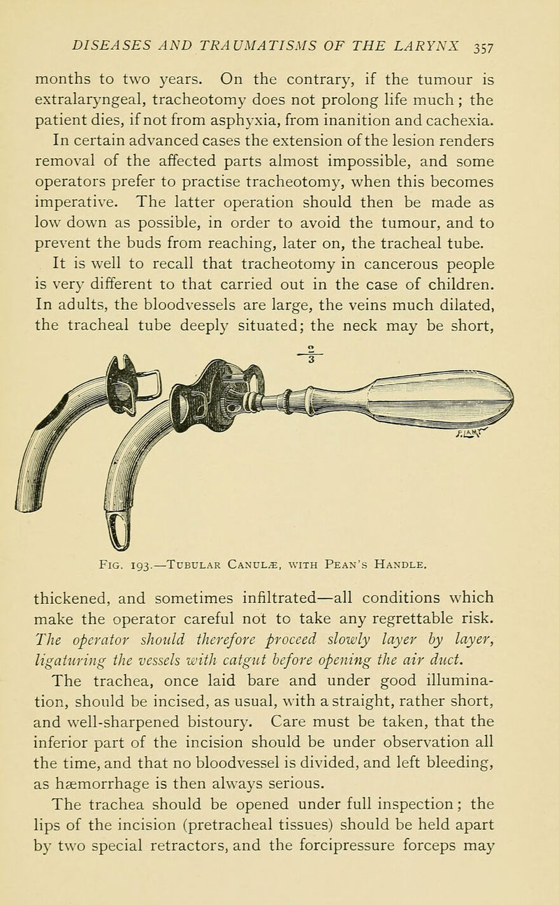 months to two years. On the contrary, if the tumour is extralaryngeal, tracheotomy does not prolong life much ; the patient dies, if not from asphyxia, from inanition and cachexia. In certain advanced cases the extension of the lesion renders removal of the affected parts almost impossible, and some operators prefer to practise tracheotomy, when this becomes imperative. The latter operation should then be made as low down as possible, in order to avoid the tumour, and to prevent the buds from reaching, later on, the tracheal tube. It is well to recall that tracheotomy in cancerous people is very different to that carried out in the case of children. In adults, the bloodvessels are large, the veins much dilated, the tracheal tube deeply situated; the neck may be short, Fig. 193.—Tubular Canule, with Pean's Handle. thickened, and sometimes infiltrated—all conditions which make the operator careful not to take any regrettable risk. The operator should therefore proceed slowly layer by layer, ligaturing the vessels with catgut before opening the air dnct. The trachea, once laid bare and under good illumina- tion, should be incised, as usual, with a straight, rather short, and well-sharpened bistoury. Care must be taken, that the inferior part of the incision should be under observation all the time, and that no bloodvessel is divided, and left bleeding, as haemorrhage is then always serious. The trachea should be opened under full inspection ; the lips of the incision (pretracheal tissues) should be held apart b}' two special retractors, and the forcipressure forceps may