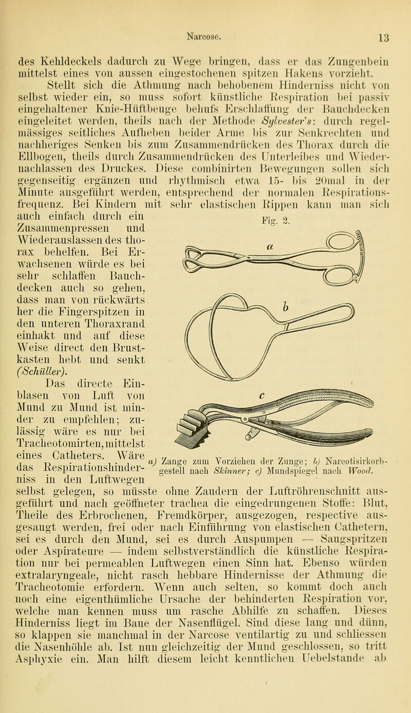 des Kehldeckels dadurch zu Weg« bringen, dass er das Zungenbein mittelst eines von aussen eingestochenen spitzen Hakens vorzieht. Stellt sich die Athniung nach behobenem Hinderniss niclit von selbst wieder ein, so muss sofort künstliche Jlpspiration bei passiv eingelialtener Knie-Hüftbeugc bcliuts l^]i'sc]ilattung der {»auchdecken eingeleitet werden, theils nacli der Methode Sylvester's: durcli regel- mässiges seitliclies Aufheben beider Arme bis zur Senkrechten und nachheriges Senken l)is zum Zusammendrücken des Thorax dur(;li die Kllbogen, theils durch Zusammendrücken des Unterleibes und Wiedei'- naclilassen des Druckes. Diese combinirten Bewegungen sollen sich gegenseitig ergänzen und rhythmisch etwa 15- bis 20mal in der Minute ausgeführt werden, entsprechend der normalen Respirations- frequenz. Bei Kindern mit sehr elastisc^hen Rippen kann man sicli auch einfach durch ein Zusammenpressen und Wiederauslassen des tho- rax behelfen. Bei Elr- wachsenen würde es bei sehr schlaifen Bauch- decken auch so gehen, dass man von rückwärts her die Fingerspitzen in den unteren Thoraxrand einhakt und auf diese Weise direct den Brust- kasten hebt und senkt (Schauer). Das directe Ein- blasen von Luft von Mund zu Mund ist min- der zu empfehlen; zu- lässig wäre es nur bei Tracheotomirten, mittelst eines Catheters. Wäre das Respirationshinder- niss in den Luftwegen selbst gelegen, so müsste ohne Zaudern der Luftröhrenschnitt aus- geführt und nach geöffneter trachea die eingedrungenen Stoffe: Blut, Theile des Erbrochenen, Fremdkörper, ausgezogen, respective aus- gesaugt werden, frei oder nach Einführung von elastischen Oathetern, sei es durch den Mund, sei es durch Auspumpen — Saugspritzen oder Aspirateure — indem selbstverständlich die künstliche Respii-a- tion nur bei permeablen Luftwegen einen Sinn hat. Ebenso würden extralaryngeale, nicht rasch hebbare Hindernisse der Athmung die Tracheotomie erfordern. Wenn auch selten, so kommt doch auch noch eine eigenthümliche Ursache der behinderten Respiration vor, welche man kennen muss um rasche Abhilfe zu schaffen. Dieses Hinderniss liegt im Baue der Nasenflügel. Sind diese lang und dünn, so klappen sie manchmal in der Nareose ventilartig zu und schliessen die Nasenhöhle ab. Ist nun gleichzeitig der Mund geschlossen, so tritt Asphyxie ein. Man hilft diesem leicht kenntlichen Uebelstande ab a) Zange zum Vorziehen der Zunge; h) Nareotisirkorb- gestell nach Skinne?-; e) MundspiegL4 naeli Wood.