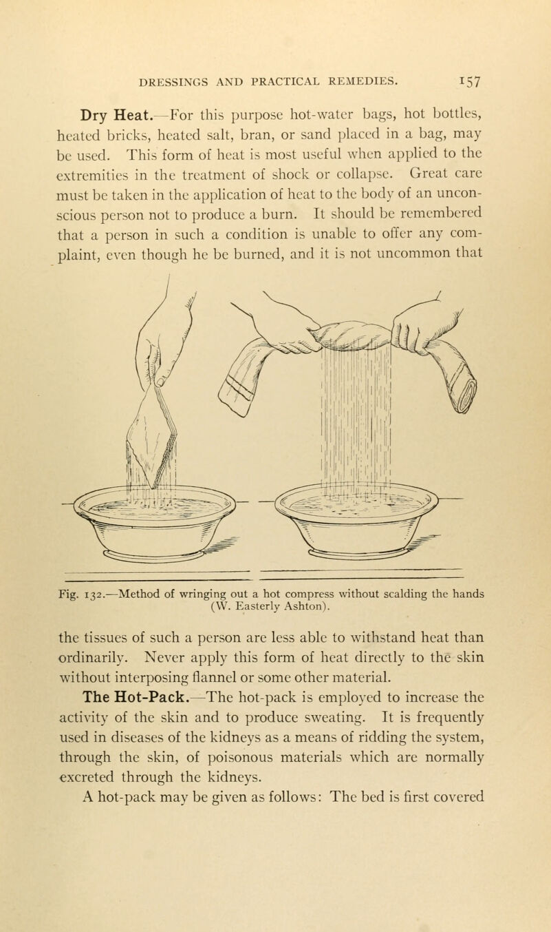 Dry Heat.—For this purpose hot-water bags, hot bottles, heated brieks, heated salt, bran, or sand placed in a bag, may be used. This form of heat is most useful when applied to the extremities in the treatment of shock or collapse. Great care must be taken in the application of heat to the body of an uncon- scious person not to produce a burn. It should be remembered that a person in such a condition is unable to offer any com- plaint, even though he be burned, and it is not uncommon that Fig. 132. -Method of wringing out a hot compress without scalding the hands (W. Easterly Ashton). the tissues of such a person are less able to withstand heat than ordinarily. Never apply this form of heat directly to the skin without interposing flannel or some other material. The Hot-Pack.—The hot-pack is employed to increase the activity of the skin and to produce sweating. It is frequently used in diseases of the kidneys as a means of ridding the system, through the skin, of poisonous materials which are normally excreted through the kidneys. A hot-pack may be given as follows: The bed is first covered