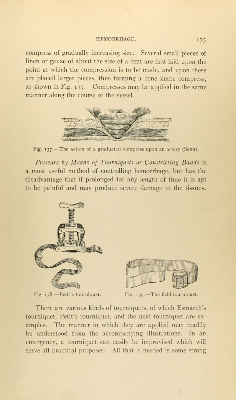 compress of gradually increasing size. Several small pieces of linen or gauze of about the size of a cent are first laid upon the point at which the compression is to be made, and upon these are placed larger pieces, thus forming a cone-shape compress, as shown in Fig. 137. Compresses may be applied in the same manner along the course of the vessel. Fig. 137.— The action of a graduated compress upon an artery (Sennj. Pressure by Means of Tourniquets or Constricting Bands is a most useful method of controlling hemorrhage, but has the disadvantage that if prolonged for any length of time it is apt to be painful and may produce severe damage to the tissues. Fig. 138.—Petit's tourniquet. Fig. 139.—Tlie field tourniquet. There arc various kinds of tourniquets, of which Esmarch's tourniquet, Petit's tourniquet, and the field tourniquet are ex- amples. The manner in which they arc applied may readily be understood from the accompanying illustrations. In an emergency, a tourniquet can easily be improvised which will serve all practical purposes. All that is needed is some strong