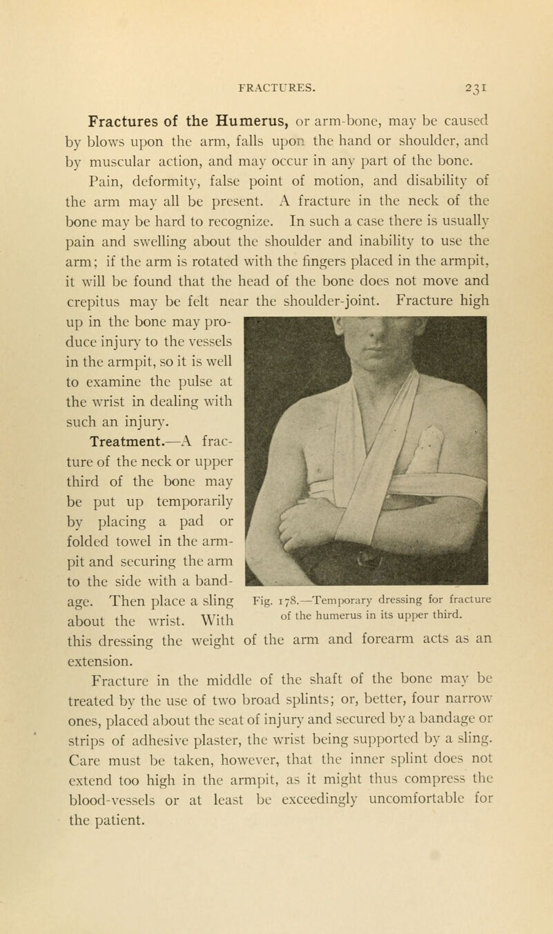 Fractures of the Humerus, or arm-bone, niay be caused by blows upon the arm, falls upon the hand or shoulder, and by muscular action, and may occur in any part of the bone. Pain, deformity, false point of motion, and disability of the arm may all be present. A fracture in the neck of the bone may be hard to recognize. In such a case there is usually pain and swelhng about the shoulder and inability to use the arm; if the arm is rotated with the fingers placed in the armpit, it will be found that the head of the bone does not move and crepitus may be felt near the shoulder-joint. Fracture high up in the bone may pro- WKKK^^^MW' duce injury to the vessels in the armpit, so it is well to examine the pulse at the wrist in dealing with such an injur}^ Treatment.—A frac- ture of the neck or upper third of the bone may be put up temporarily by placing a pad or folded towel in the arm- pit and securing the arm to the side with a band- age. Then place a sling about the wrist. With this dressing the weight of the arm and forearm acts as an extension. Fracture in the middle of the shaft of the bone may be treated by the use of two broad sphnts; or, better, four narrow ones, placed about the seat of injury and secured by a bandage or strips of adhesive plaster, the wrist being supported by a sling. Care must be taken, however, that the inner splint does not extend too high in the armpit, as it might thus compress the blood-vessels or at least be exceedingly uncomfortable for the patient. Fit 178.—Temporary dressing for fracture of the humerus in its upper third.