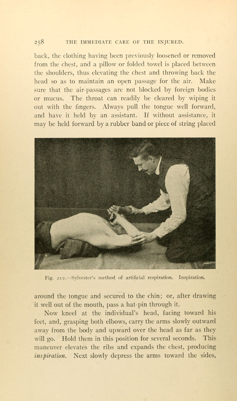 back, the clothing having been previously loosened or removed from the chest, and a pillow or folded towel is placed between the shoulders, thus elevating the chest and throwing back the head so as to maintain an open passage for the air. Make sure that the air-passages are not blocked by foreign bodies or mucus. The throat can readily be cleared by wiping it out with the fingers. Always pull the tongue well forward, and have it held by an assistant. If without assistance, it may be held forward by a rubber band or piece of string placed Fig. 2 12.—Sylvester's method of artificial respiration. Inspiration. around the tongue and secured to the chin; or, after drawing it well out of the mouth, pass a hat-pin through it. Now kneel at the individual's head, facing toward his feet, and, grasping both elbows, carry the arms slowly outward away from the body and upward over the head as far as they will go. Hold them in this position for several seconds. This maneuver elevates the ribs and expands the chest, producing inspiration. Next slowly depress the arms toward the sides,