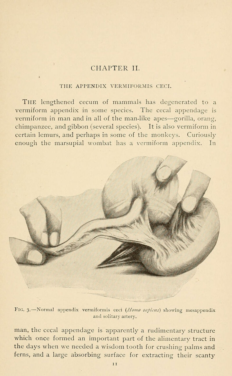 THE APPENDIX VERMIFORMIS CECI. The lengthened cecum of mammals has degenerated to a vermiform appendix in some species. The cecal appendage is vermiform in man and in all of. the man-like apes—gorilla, orang, chimpanzee, and gibbon (several species). It is also vermiform in certain lemurs, and perhaps in some of the monkeys. Curiously enough the marsupial wombat has a vermiform appendix. In Fig. 3.—Norma] appendix vermiformis ceci {Homo sapiens) showing mesappendix and solitary artery. man, the cecal appendage is apparently a rudimentary structure which once formed an important part of the alimentary tract in the days when we needed a wisdom tooth for crushing palms and ferns, and a large absorbing surface for extracting their scanty