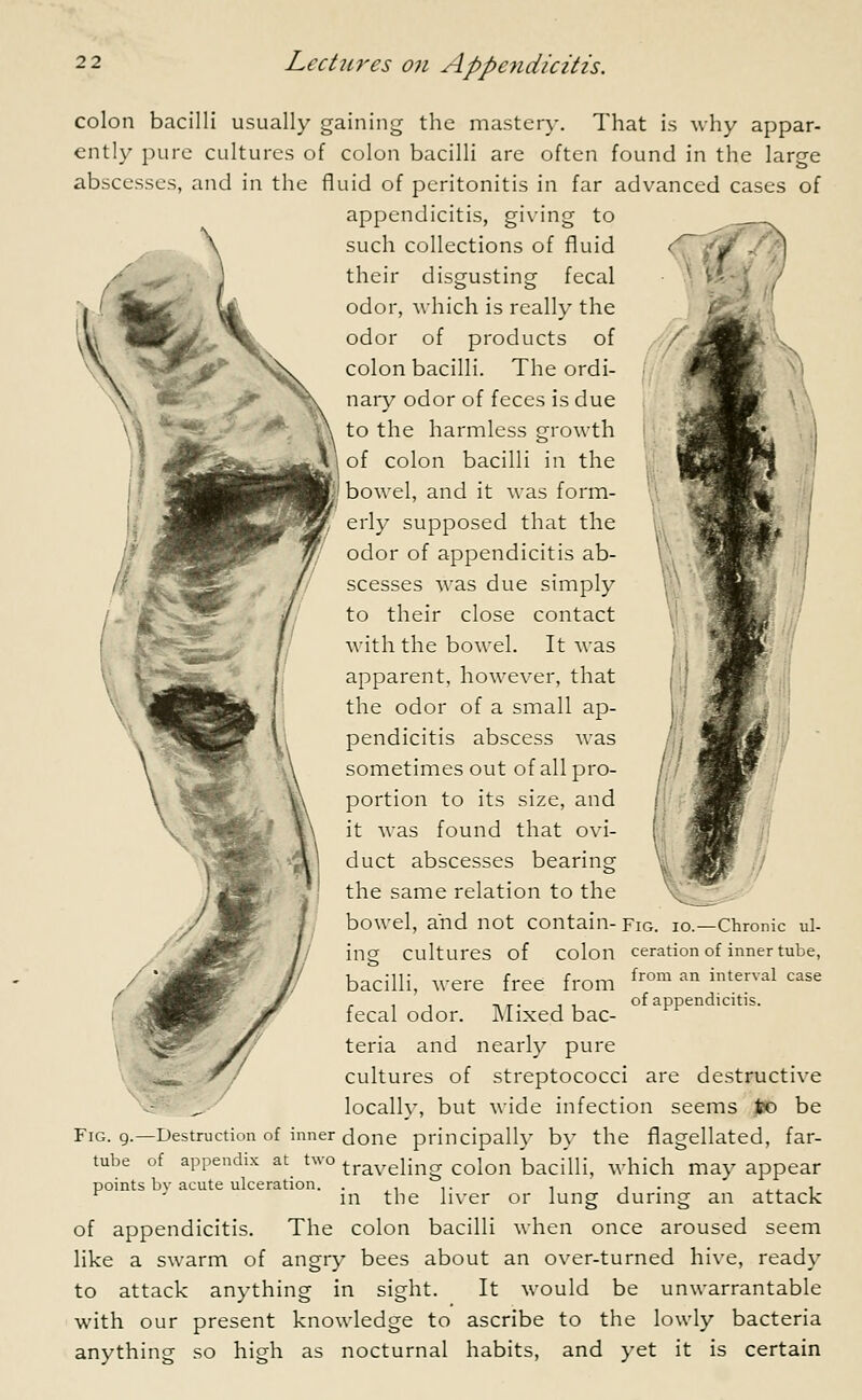 colon bacilli usually gaining the mastery. That is why appar- ently pure cultures of colon bacilli are often found in the large abscesses, and in the fluid of peritonitis in far advanced cases of appendicitis, giving to such collections of fluid > /A their disgusting fecal odor, which is really the odor of products of colon bacilli. The ordi- nary odor of feces is due to the harmless growth of colon bacilli in the bowel, and it was form- erly supposed that the odor of appendicitis ab- scesses was due simply to their close contact with the bowel. It was apparent, however, that the odor of a small ap- pendicitis abscess was sometimes out of all pro- portion to its size, and it was found that ovi- duct abscesses bearing the same relation to the bowel, and not contain-Fig. io.—Chronic til- ing cultures of Colon ceration of inner tube, bacilli, were free from from an intenal case i\ of appendicitis. fecal odor. Mixed bac- teria and nearly pure cultures of streptococci are destructive locally, but wide infection seems jfco be Fig. 9.—Destruction of inner done principally by the flagellated, far- tube of appendix at two traveiing coion bacilli, which may appear points bv acute ulceration. .... . . , m the liver or lung during an attack of appendicitis. The colon bacilli when once aroused seem like a swarm of angry bees about an over-turned hive, ready to attack anything in sight. It would be unwarrantable with our present knowledge to ascribe to the lowly bacteria anything so high as nocturnal habits, and yet it is certain