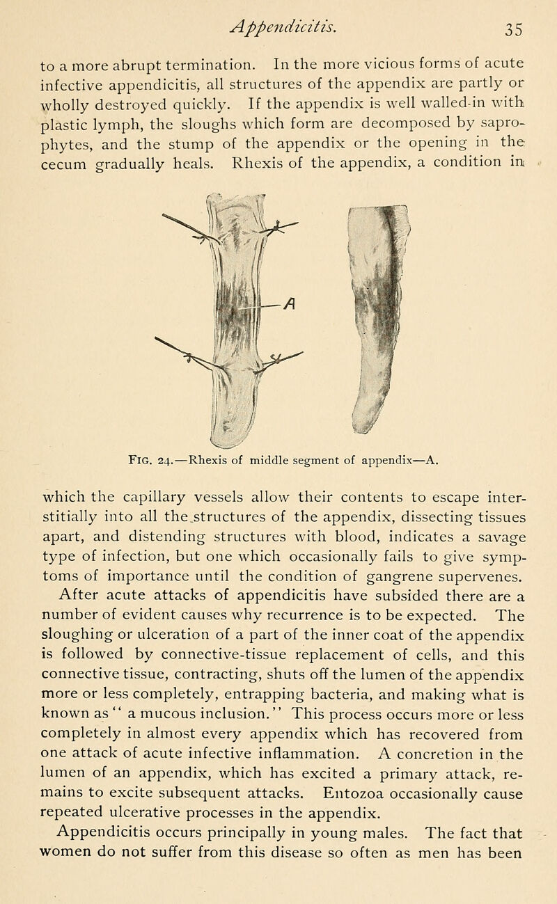 to a more abrupt termination. In the more vicious forms of acute infective appendicitis, all structures of the appendix are partly or wholly destroyed quickly. If the appendix is well walled-in with plastic lymph, the sloughs which form are decomposed by sapro- phytes, and the stump of the appendix or the opening in the cecum gradually heals. Rhexis of the appendix, a condition ini Fig. 24.—Rhexis of middle segment of appendix—A. which the capillary vessels allow their contents to escape inter- stitially into all the.structures of the appendix, dissecting tissues apart, and distending structures with blood, indicates a savage type of infection, but one which occasionally fails to give symp- toms of importance until the condition of gangrene supervenes. After acute attacks of appendicitis have subsided there are a number of evident causes why recurrence is to be expected. The sloughing or ulceration of a part of the inner coat of the appendix is followed by connective-tissue replacement of cells, and this connective tissue, contracting, shuts off the lumen of the appendix more or less completely, entrapping bacteria, and making what is known as  a mucous inclusion. This process occurs more or less completely in almost every appendix which has recovered from one attack of acute infective inflammation. A concretion in the lumen of an appendix, which has excited a primary attack, re- mains to excite subsequent attacks. Entozoa occasionally cause repeated ulcerative processes in the appendix. Appendicitis occurs principally in young males. The fact that women do not suffer from this disease so often as men has been