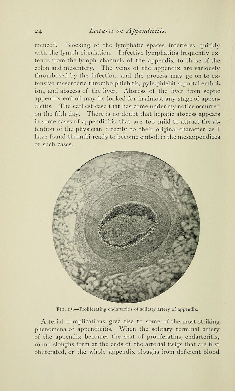 menced. Blocking of the lymphatic spaces interferes quickly with the lymph circulation. Infective lymphatitis frequently ex- tends from the lymph channels of the appendix to those of the colon and mesentery. The veins of the appendix are variously thrombosed by the infection, and the process may go on to ex- tensive mesenteric thrombo-phlebitis, pyle-phlebitis, portal embol- ism, and abscess of the liver. Abscess of the liver from septic appendix emboli may be looked for in almost any stage of appen- dicitis. The earliest case that has come under my notice occurred on the fifth day. There is no doubt that hepatic abscess appears in some cases of appendicitis that are too mild to attract the at- tention of the physician directly to their original character, as I have found thrombi ready to become emboli in the mesappendices of such cases. Fig. 13.—Proliferating endarteritis of solitary artery of appendix. Arterial complications give rise to some of the most striking phenomena of appendicitis. When the solitary terminal artery of the appendix becomes the seat of proliferating endarteritis, round sloughs form at the ends of the arterial twigs that are first obliterated, or the whole appendix sloughs from deficient blood