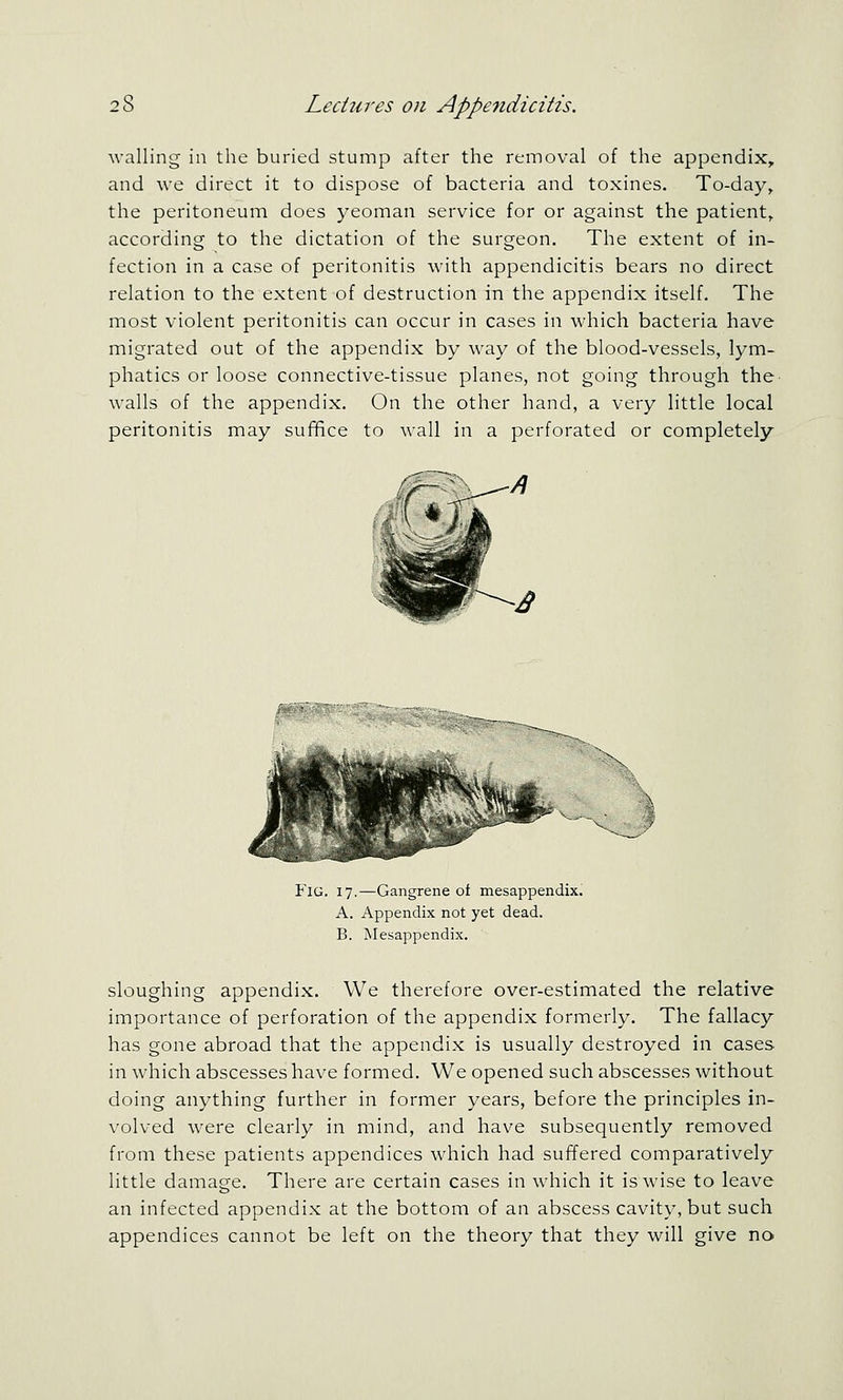 walling in the buried stump after the removal of the appendix, and we direct it to dispose of bacteria and toxines. To-day, the peritoneum does yeoman service for or against the patient, according to the dictation of the surgeon. The extent of in- fection in a case of peritonitis with appendicitis bears no direct relation to the extent of destruction in the appendix itself. The most violent peritonitis can occur in cases in which bacteria have migrated out of the appendix by w-ay of the blood-vessels, lym- phatics or loose connective-tissue planes, not going through the walls of the appendix. On the other hand, a very little local peritonitis may suf^ce to wall in a perforated or completely Fig. 17.—Gangrene of mesappendix, A. Appendix not yet dead. B. Mesappendix. sloughing appendix. We therefore over-estimated the relative importance of perforation of the appendix formerly. The fallacy has gone abroad that the appendix is usually destroyed in cases in which abscesses have formed. We opened such abscesses without doing anything further in former years, before the principles in- volved were clearly in mind, and have subsequently removed from these patients appendices which had suffered comparatively little damage. There are certain cases in which it is wise to leave an infected appendix at the bottom of an abscess cavity, but such appendices cannot be left on the theory that they will give no