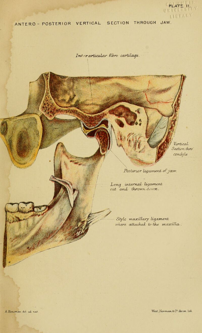 ANTERO - POBTERIOR VERTICAL SECTION THROUGH JAW. Inf-^rarbLojiLar izhro cartiloicfe.. VarticnL Sectwi thro' ronajf l^e Posterior Ixgajyverd- of jaw. Long intemoL Ucfowrient cut. ounaL -ttirowrc dci/n. Style maxillary U^ounteyvt vhere aHxtcked^ tp ike yyiax.iHou. A.Hen^m/wi 6A tuL >tat Ylist 'He.wnuufv & C^ dlrtnu. UA-