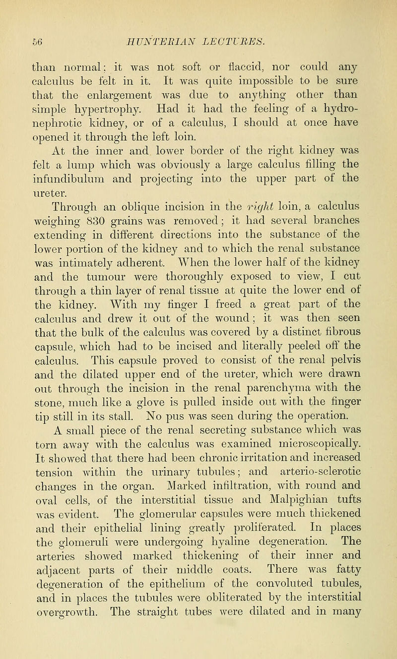 than normal; it was not soft or flaccid, nor could any calculus be felt in it. It was quite impossible to be sure that the enlargement was due to anything other than simple hypertrophy. Had it had the feeling of a hydro- nephrotic kidney, or of a calculus, I should at once have opened it through the left loin. At the inner and lower border of the right kidney was felt a lump which was obviously a large calculus filling the infundibulum and projecting into the upper part of the ureter. Through an oblique incision in the right loin, a calculus weighing 830 grains was removed; it had several branches extending in different directions into the substance of the lower portion of the kidney and to which the renal substance was intimately adherent. When the lower half of the kidney and the tumour were thoroughly exposed to view, I cut through a thin layer of renal tissue at quite the lower end of the kidney. With my finger I freed a great part of the calculus and drew it out of the wound; it was then seen that the bulk of the calculus was covered by a distinct fibrous capsule, which had to be incised and literally peeled off the calculus. This capsule proved to consist of the renal pelvis and the dilated upper end of the ureter, which were drawn out through the incision in the renal parenchyma with the stone, much like a glove is pulled inside out with the finger tip still in its stall. No pus was seen during the operation. A small piece of the renal secreting substance which was torn away with the calculus was examined microscopically. It showed that there had been chronic irritation and increased tension within the urinary tubules; and arterio-sclerotic changes in the organ. Marked infiltration, with round and oval cells, of the interstitial tissue and Malpighian tufts was evident. The glomerular capsules were much thickened and their epithelial lining greatly proliferated. In places the glomeruli were undergoing hyaline degeneration. The arteries showed marked thickening of their inner and adjacent parts of their middle coats. There was fatty degeneration of the epithelium of the convoluted tubules, and in places the tubules were obliterated by the interstitial overgrowth. The straight tubes were dilated and in many