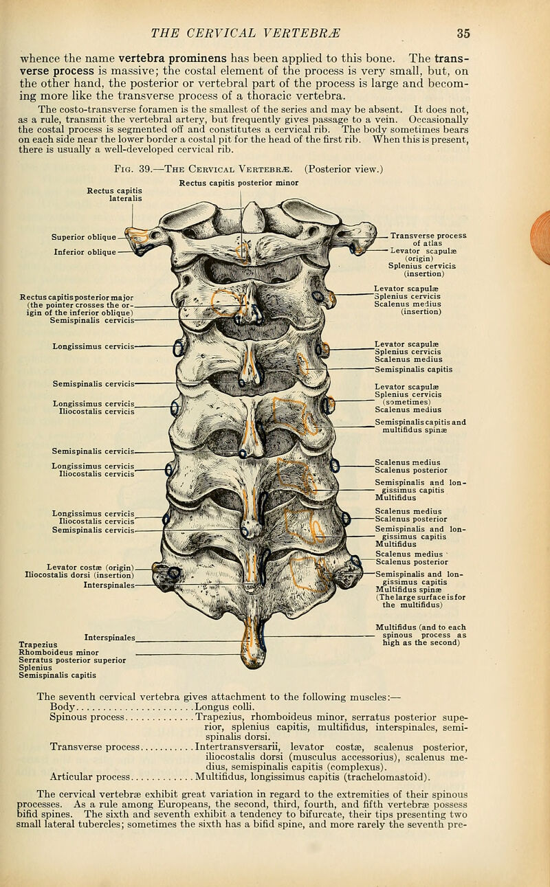 whence the name vertebra prominens has been applied to this bone. The trans- verse process is massive; the costal element of the process is very small, but, on the other hand, the posterior or vertebral part of the process is large and becom- ing more like the transverse process of a thoracic vertebra. The costo-transverse foramen is the smallest of the series and may be absent. It does not, as a rule, transmit the vertebral artery, but frequently gives passage to a vein. Occasionally the costal process is segmented off and constitutes a cervical rib. The body sometimes bears on each side near the lower border a costal pit for the head of the first rib. When this is present, there is usually a well-developed cervical rib. Fig. 39.—The Cervical Vertebra. (Posterior view.) Rectus capitis posterior minor Superior oblique ■ oblique Rectus capitis posterior major (the pointer crosses the or- igin of the inferior oblique) Semispinalis cervicis- Semispinalis cervicis. Longissimus cervicis Iliocostalis cervicis Semispinal: Levator costse (origin) Iliocostalis dorsi (insertion) Interspinales Interspinales Trapezius Rhomboideus minor Serratus posterior superior Splenius Semispinalis capitis Transverse process of atlas Levator scapulae (origin) Splenius cervicis (.insertion) Levator scapulse -pie ■ Scalenus medius (insertion) Levator scapulae 'Splenius cervicis Scalenus medius Semispinalis capitis Levator scapulae Sple ■ (sometimes) Scalenus medius i Scalenus medius Scalenus posterior spinalis and lon- gissimus capitis Multifidus medius posterior spinalis and lon- gissimus capitis Multifidus Scalenus medius ' Scalenus posterior Semispinalis and lon- gissimus capitis Multifidus spinas (The large surface isfor the multifidus) Multifidus (and to each spinous process as high as the second) The seventh cervical vertebra gives attachment to the following muscles:— Body Longus coUi. Spinous process Trapezius, rhomboideus minor, serratus posterior supe- rior, splenius capitis, multifidus, interspinales, semi- spinalis dorsi. Transverse process Intertransversarii, levator costse, scalenus posterior, iliocostahs dorsi (musculus accessorius), scalenus me- dius, semispinalis capitis (complexus). Articular process Multifidus, longissimus capitis (trachelomastoid). The cervical vertebrae exhibit great variation in regard to the extremities of their spinous processes. As a rule among Europeans, the second, third, fourth, and fifth vertebrae possess bifid spines. The sixth and seventh exhibit a tendency to bifurcate, their tips presenting two small lateral tubercles; sometimes the sixth has a bifid spine, and more rarely the seventh pre-
