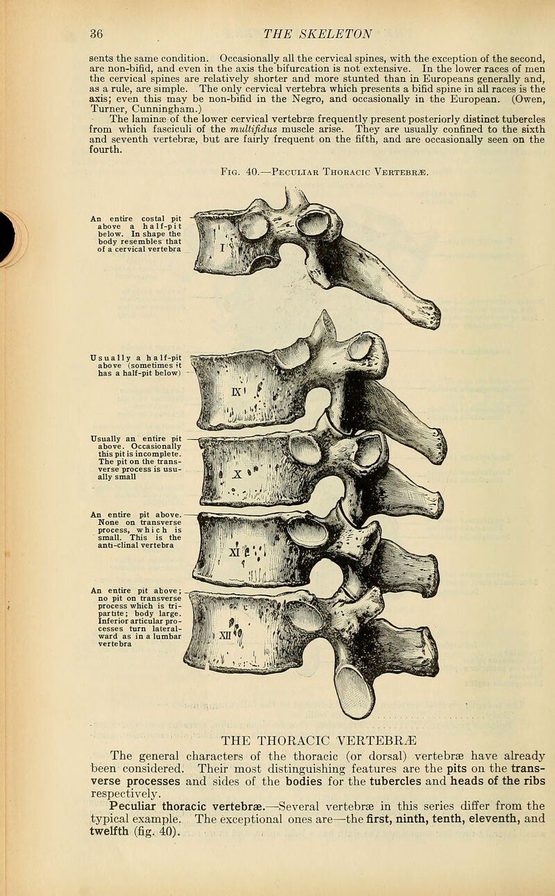 sents the same condition. Occasionally all the cervical spines, with the exception of the second, are non-bifid, and even in the axis the bifurcation is not extensive. In the lower races of men the cervical spines are relatively shorter and more stunted than in Europeans generally and, as a rule, are simple. The only cervical vertebra which presents a bifid spine in all races is the axis; even this may be non-bifid in the Negro, and occasionally in the European. (Owen, Turner, Cunningham.) The laminae of the lower cervical vertebrae frequently present posteriorly distinct tubercles from which fasciculi of the muUifidus muscle arise. They are usually confined to the sixth and seventh vertebrae, but are fairly frequent on the fifth, and are occasionally seen on the fourth. Fig. 40.—Peculiar Thoracic Vertebra. An entire costal pit above a half-pit below. In shape the body resembles that of a cervical vertebra Jsually a ha If-pit above (sometimes 't has a half-pit below) Usually an entire pit above. Occasionally this pit is incomplete The pit on the trans- verse process is usu- ally small An entire pit above, no pit on transverse process which is tri- partite; body large Inferior articular pro- cesses turn lateral- ward as in a lumbar vertebra THE THORACIC VERTEBRA The general characters of the thoracic (or dorsal) vertebrae have already been considered. Their most distinguishing features are the pits on the trans- verse processes and sides of the bodies for the tubercles and heads of the ribs respectively. Peculiar thoracic vertebrae.—Several vertebrae in this series differ from the typical example. The exceptional ones are—the first, ninth, tenth, eleventh, and twelfth (fig. 40). .