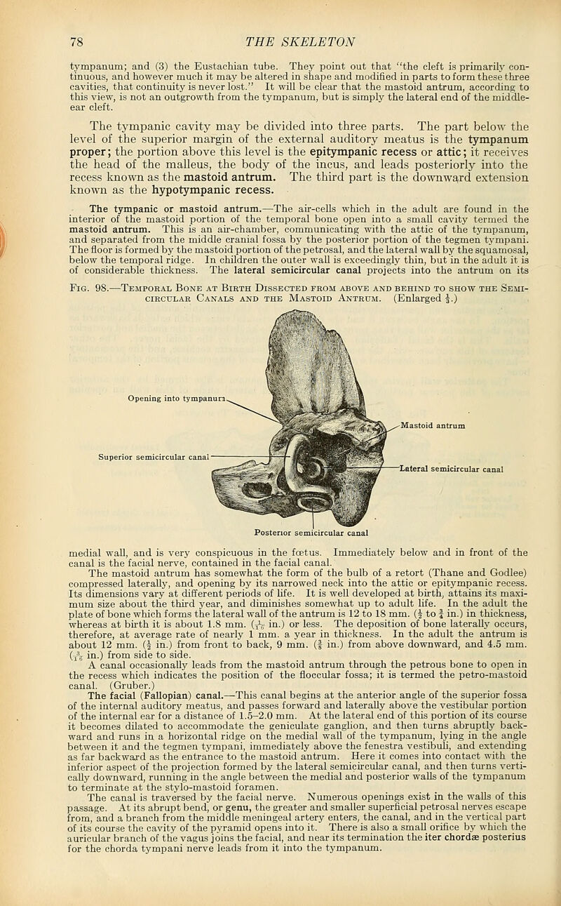 tympanum; and (3) the Eustachian tube. They point out that the cleft is primarily con- tinuous, and however much it may be altered in shape and modified in parts to form these three cavities, that continuity is never lost. It will be clear that the mastoid antrum, according to this view, is not an outgrowth from the tympanum, but is simply the lateral end of the middle- ear cleft. The tympanic cavity may be divided into three parts. The part below the level of the superior margin of the external auditory meatus is the tympanum proper; the portion above this level is the epitympanic recess or attic; it receives the head of the malleus, the body of the incus, and leads posteriorly into the recess known as the mastoid antrum. The third part is the downward extension known as the hypotympanic recess. The tympanic or mastoid antrum.—The air-cells which in the adult are found in the interior of the mastoid portion of the temporal bone open into a small cavity termed the mastoid antrum. This is an air-chamber, communicating with the attic of the tympanum, and separated from the middle cranial fossa by the posterior portion of the tegmen tympani. The floor is formed by the mastoid portion of the petrosal, and the lateral wall by the squamosal, below the temporal ridge. In children the outer wall is exceedingly thin, but in the adult it ia of considerable thickness. The lateral semicircular canal projects into the antrum on its Fig. 98. -Temporal Bone at Birth Dissected prom above and behind to show the Semi- circular Canals and the Mastoid Antrum. (Enlarged \.) Opening into tympanura Superior semicircular canal Mastoid antrum 'Lateral semicircular canal Posterior semicircular canal medial wall, and is very conspicuous in the foetus. Immediately below and in front of the canal is the facial nerve, contained in the facial canal. The mastoid antrum has somewhat the form of the bulb of a retort (Thane and Godlee) compressed laterally, and opening by its narrowed neck into the attic or epitympanic recess. Its dimensions vary at different periods of hfe. It is well developed at birth, attains its maxi- mum size about the third year, and diminishes somewhat up to adult life. In the adult the plate of bone which forms the lateral wall of the antrum is 12 to 18 mm. (| to J in.) in thickness, whereas at bu-th it is about 1.8 mm. (j^ in.) or less. The deposition of bone laterally occurs, therefore, at average rate of nearly 1 mm. a year in thickness. In the adult the antrum ia about 12 mm. (i in.) from front to back, 9 mm. (f in.) from above downward, and 4.5 mm. (j^V in.) from side to side. A canal occasionally leads from the mastoid antrum through the petrous bone to open in the recess which indicates the position of the fioecular fossa; it is termed the petro-mastoid canal. (Gruber.) The facial (Fallopian) canal.—This canal begins at the anterior angle of the superior fossa of the internal auditory meatus, and passes forward and laterally above the vestibular portion of the internal ear for a distance of 1.5-2.0 mm. At the lateral end of this portion of its course it becomes dilated to accommodate the geniculate ganglion, and then turns abruptly back- ward and runs in a horizontal ridge on the medial wall of the tympanurn, lying in the angle between it and the tegmen tympani, immediately above the fenestra vestibuli, and extending as far backward as the entrance to the mastoid antrum. Here it comes into contact with the inferior aspect of the projection formed by the lateral semicircular canal, and then turns verti- cally downward, running in the angle between the medial and posterior walls of the tympanum to terminate at the stylo-mastoid foramen. The canal is traversed by the facial nerve. Numerous openings exist in the walls of this passage. At its abrupt bend, or genu, the greater and smaller superficial petrosal nerves escape from, and a branch from the middle meningeal artery enters, the canal, and in the vertical part of its course the cavity of the pyramid opens into it. There is also a small orifice by which the auricular branch of the vagus joins the facial, and near its termination the iter chordae posterius for the chorda tympani nerve leads from it into the tympanum.