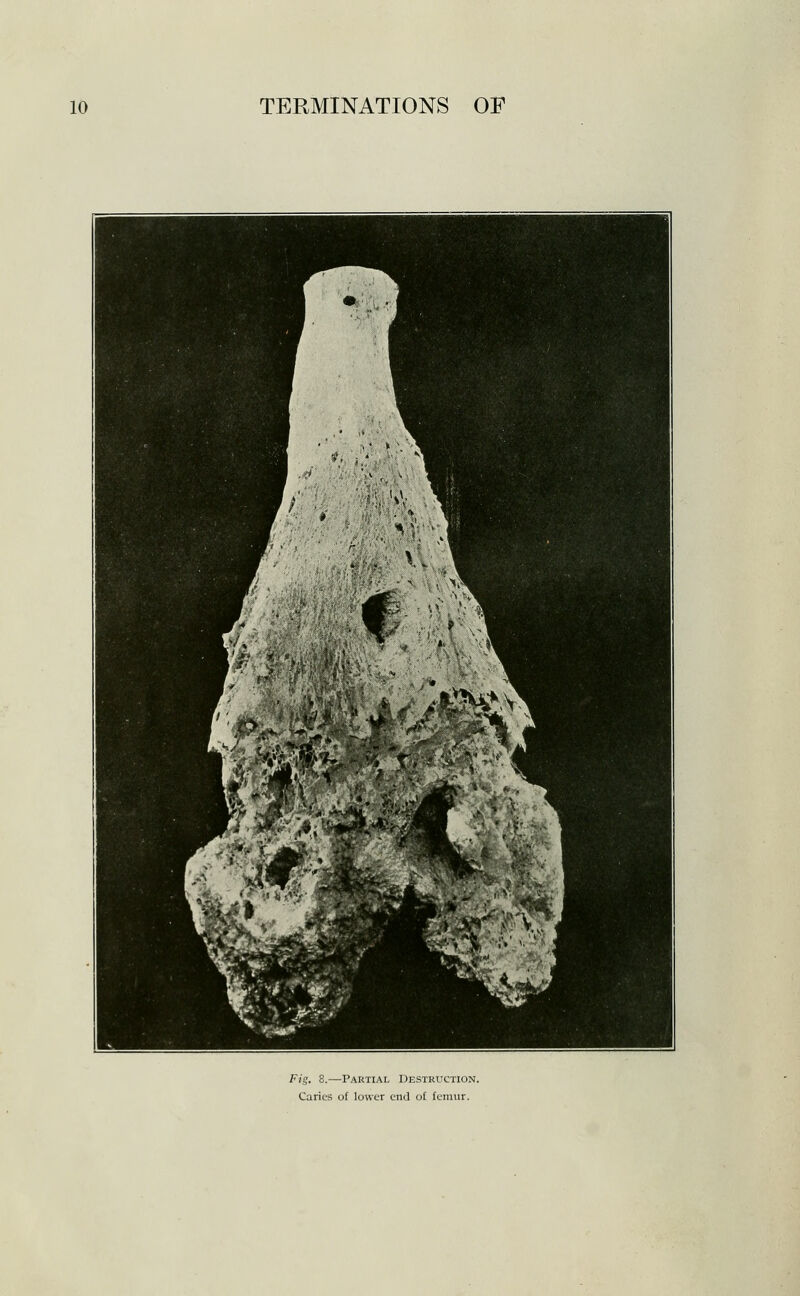 Fig. 8.—Partial Destruction. Caries of lower end of femur.