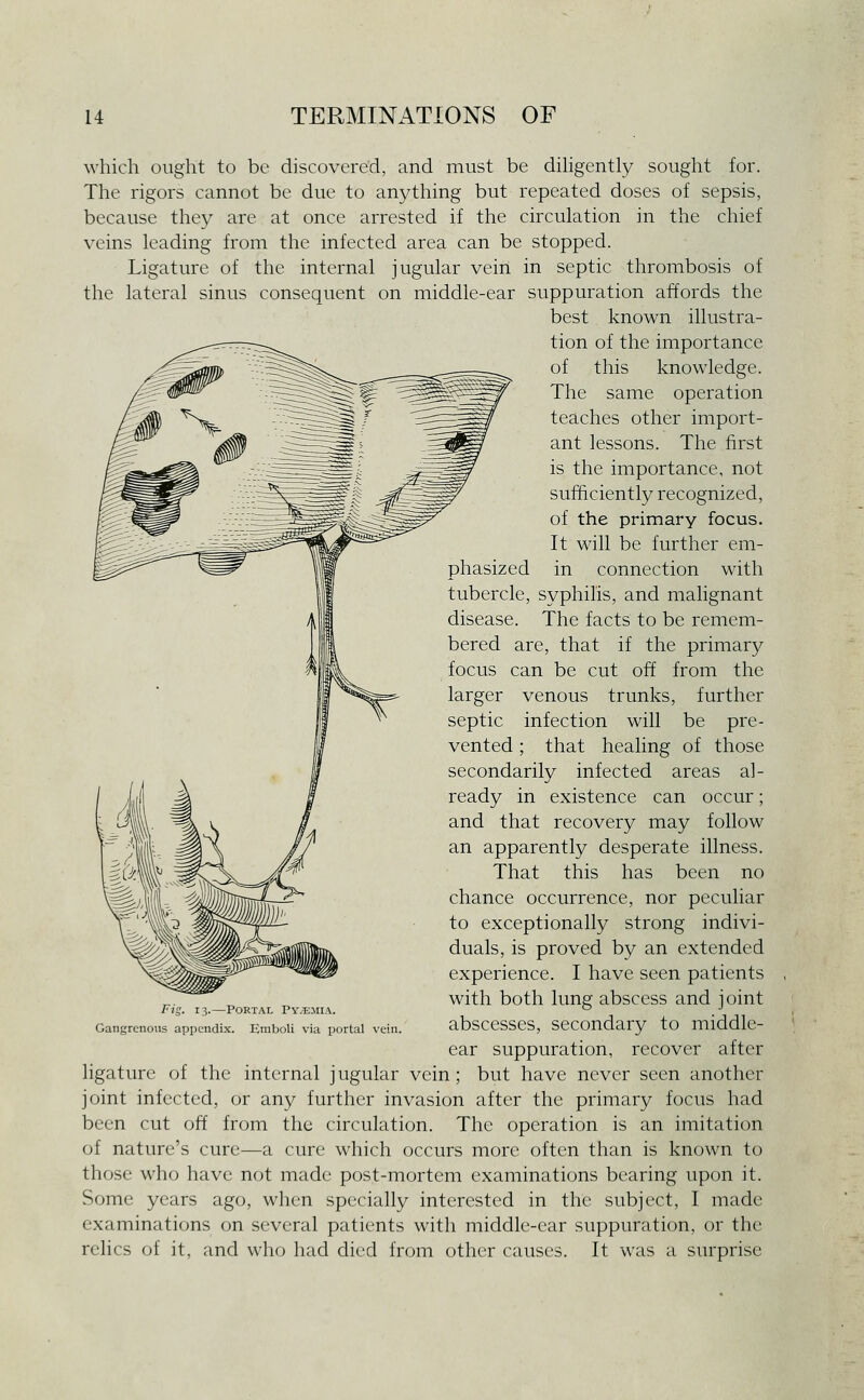 which ought to be discovered, and must be dihgently sought for. The rigors cannot be due to anything but repeated doses of sepsis, because they are at once arrested if the circulation in the cliief veins leading from the infected area can be stopped. Ligature of the internal jugular vein in septic thrombosis of the lateral sinus consequent on middle-ear suppuration affords the best known illustra- tion of the importance of this knowledge. The same operation teaches other import- ant lessons. The first is the importance, not sufficiently recognized, of the primary focus. It will be further em- connection with phasized in tubercle, syphilis, and malignant disease. The facts to be remem- bered are, that if the primary focus can be cut off from the larger venous trunks, further septic infection will be pre- vented ; that healing of those secondarily infected areas al- ready in existence can occur; and that recovery may follow an apparently desperate illness. That this has been no chance occurrence, nor peculiar to exceptionally strong indivi- duals, is proved by an extended experience. I have seen patients with both lung abscess and joint abscesses, secondary to middle- ear suppuration, recover after ligature of the internal j ugular vein ; but have never seen another joint infected, or any further invasion after the primary focus had been cut off from the circulation. The operation is an imitation of nature's cure—a cure which occurs more often than is known to those who have not made post-mortem examinations bearing upon it. Some years ago, when specially interested in the subject, I made examinations on several patients with middle-ear suppuration, or the relics of it, and who had died from other causes. It was a surprise Fi'^. 13.—Portal Py.emia. Gangrenous appendix. Emboli via portal vein.