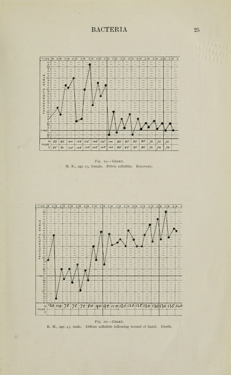 TIME M e;m ev em em em e;m e M E M E  E M eIm e M E M E M E M E 104 «- i 103 0 6- U) *- 2- Ul 102 ^ 1: 1 2- 2 101 C 6 - 1 * 2 100 iz 2- 99 98 a- — 3 - - =* z - - Z - — I z z Z E - E 3^ = 5 5 E E E E E E E ^ ~r A I ^l v'K = = E =^ E z E E E _|]e|[= \i ^ E E E _ E E E E ^ z -1 (E z _ E z E E E E E E r^E z E ^ ~ E w \ ^f\ I =n z E^ E - - — — — - z 1f ^/ Vr A^ ^ ^ / ^- - - - - f i-; - ^- i -. _ — - — — — — *-:-:-*-!- -^ - — — M PULSE E rr rr /ee /*r /er /or /nr /■o* t rr 1 rr rr sr /^ 7'- /^ rr .0 /tr /or /or /er /ir /oe i ^.r 1 yr 1 rr rr /^ r /^ Fig. 19.—Chart. jr. R., age 23, female. Pelvic cellulitis. Recoven-. TIME M E'M eIm E M EiM EIm EIM E M E M ElM E M E M E M E M E M EM eIh E 104 a- 0 6- « 4- U) 102 ^- • ul tl X 2- Z 101 q: e- 2 100 t2 2^ 99 .1, r»M.'t- 96 e— 2- ■S7 a- 2- 9S- M - - - - - 1 - 1 -- - - 1 - - - — - .- _. 1 _ E E E E E = z = = E E E Ef 5'1 z z E E E E E 3 _ E ~_1- ^ = ZM ? ¥ E/ E E E E ~ ~i\ _1v _ 1 _ 'E liE z ii= z E E E E —A J - - E z E E E E z E = E =! E = (E E z E E E E E E E z A^ /^ -f f - 1 - - - - - z z z z z -l-iv-\^ - - - - — — _. -  - i z 4^ EJE _ E E E E E E E E — 1= z E E E z E _ E E E E E E E E •20 //o 7^ yi 7^ fo c^o ^5- ItO ao\no itr /20 /30 130(^5- /t,o E - i 1 1 F;?. 20.—Chart. R. H., age 43, male. Diffuse cellulitis follo'wing wound of hand.