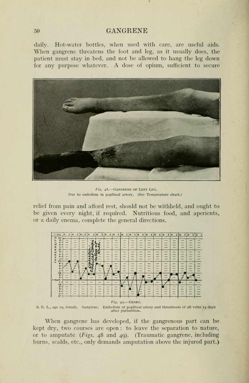 daily. Hot-water bottles, when used with care, are useful aids. When gangrene threatens the foot and leg, as it usually does, the patient must stay in bed, and not be allowed to hang the leg down for any purpose whatever. A dose of opium, sufficient to secure Fiij. 48.—Gangrene of Left I,eg. Due to embolism in popliteal artery. (See Temperature chart.) relief from pain and afford rest, should not be withheld, and ought to be given every night, if required. Nutritious food, and aperients, or a daily enema, complete the general directions. Fig. 49.—Chart. S. E. I,., age 29, female. Gangrene. Embolism of popliteal artery and thrombosis of all veins 14 days after parturition. When gangrene has developed, if the gangrenous part can be kept dry, two courses are open : to leave the separation to nature, or to amputate {Figs. 48 and 49). (Traumatic gangrene, including burns, scalds, etc., only demands amputation above the injured part.)