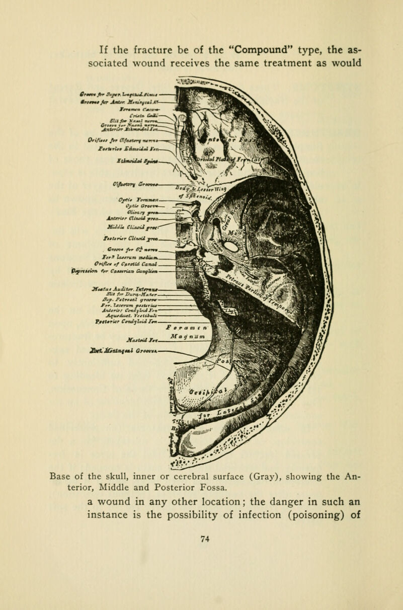 If the fracture be of the Compound type, the as- sociated wound receives the same treatment as would Or»m Jhr Suptr. L~fi*tj.0im., ■VMMf fwT Anl/r Mint'mftilA Criit* CmMi SlU fir ^ • — 1 <wi Cr,..-. ».- AV.-J an QrifUu frr OtfaMlfry ndnn Ol/krary ttrmtm Ojfti* JVfVHL OjttU Or— Olivary prrm AjiUrier CllasU rrr, XulJU CluunJi jprrx fmtUrirr CliiviH frea Cretn- f,r 6* TtrS lajerum nudium. CrifU* ./ CutU Canal Pspnuim ttr Ca*nrma Caelum 2f**tut Auditor. Ixtmiu- Slit f*r Uura-ATattr *5Vp. PdtrrtAl g F ■ l*cmm »*iu A-Utrier Cc+iylout Fo* Aqutduet. Vttt\bt*h Ytttrrlcr CmJyUvl Fm Afajtaid Jrt. Base of the skull, inner or cerebral surface (Gray), showing the An- terior, Middle and Posterior Fossa. a wound in any other location; the danger in such an instance is the possibility of infection (poisoning) of