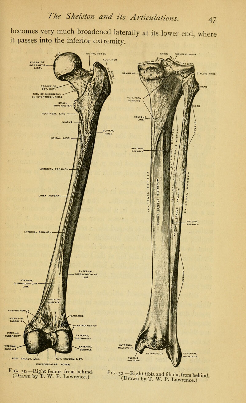 becomes very much broadened laterally at its lower end, where it passes into the inferior extremity. FOSSk INTCBARTIC.- LICT POST. CnuCL'i UuT. ANT. cnuCtAU UCT. lUTCRCOKOVLAR NOTCH Fjg. 31.—Right femur, from behind. (Drawn by T. W. P. Lawrence.) Fig. 32^Right tibia and fibula, from behind (Drawn by T. W. P. Lawrence.)