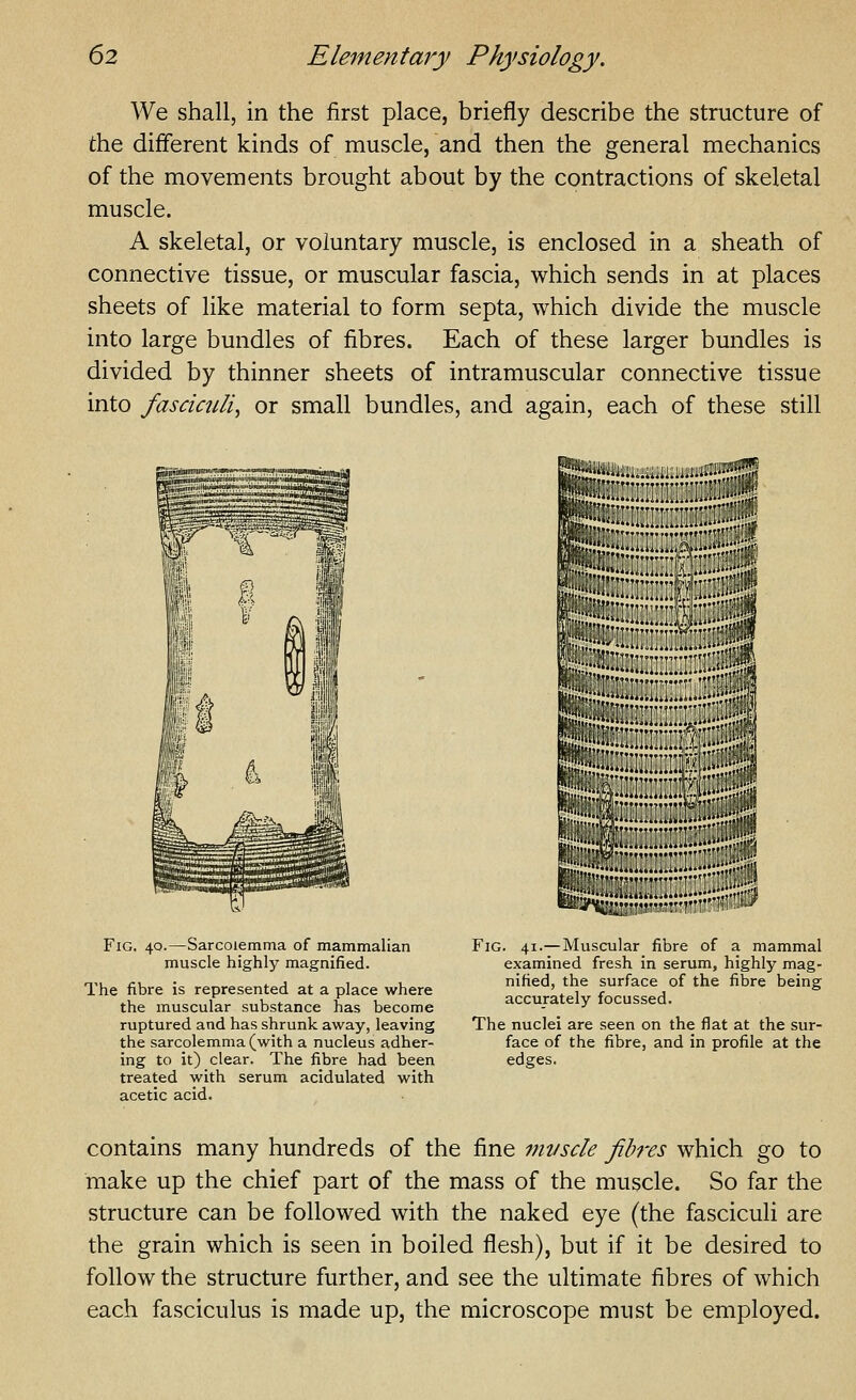 We shall, in the first place, briefly describe the structure of the different kinds of muscle, and then the general mechanics of the movements brought about by the contractions of skeletal muscle. A skeletal, or voluntary muscle, is enclosed in a sheath of connective tissue, or muscular fascia, which sends in at places sheets of like material to form septa, which divide the muscle into large bundles of fibres. Each of these larger bundles is divided by thinner sheets of intramuscular connective tissue into fasciaili, or small bundles, and again, each of these still »iii;i;uii;aiiiiiiE:;!!H?^ m- Fig. 40.—Sarcoiemma of mammalian muscle highly magnified. The fibre is represented at a place where the muscular substance has become ruptured and has shrunk away, leaving the sarcoiemma (with a nucleus adher- ing to it) clear. The fibre had been treated with serum acidulated with acetic acid. BiiiiiiiiiiiiHiniiiiHiii iiillllHliHIllHg iniiii:ii!:i|iiii ii illlllilllllllllllBllil iiiiiiiinii;aiiii| iiiiiiiniiiiHi;!!^* iiliiii'i'ffllliiii [Illlliiljilililili ii:::in:ii i li nilliiiiii Fig. 41.—Muscular fibre of a mammal examined fresh in serum, highly mag- nified, the surface of the fibre being accurately focussed. The nuclei are seen on the flat at the sur- face of the fibre, and in profile at the edges, contains many hundreds of the fine mt/scle fibres which go to make up the chief part of the mass of the muscle. So far the structure can be followed with the naked eye (the fasciculi are the grain which is seen in boiled flesh), but if it be desired to follow the structure further, and see the ultimate fibres of which each fasciculus is made up, the microscope must be employed.