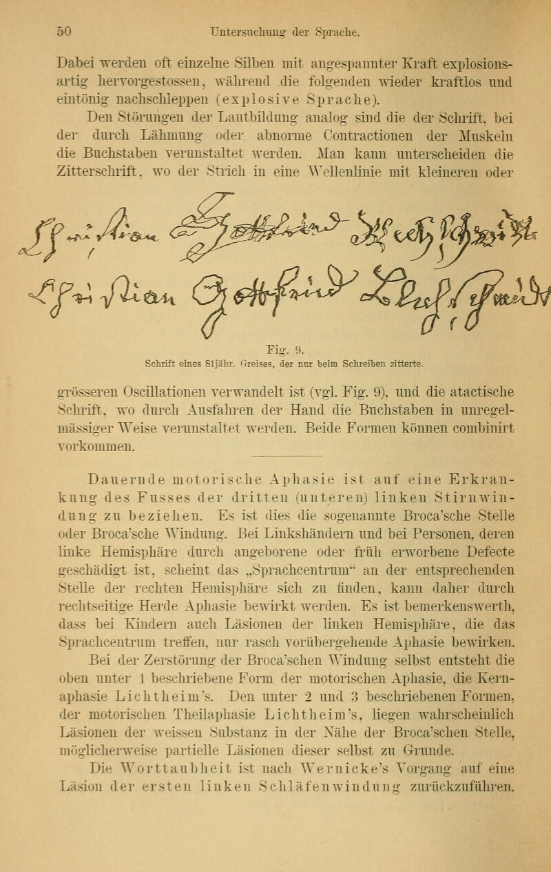 Dabei werden oft einzelne Silben mit angespannter Kraft explosions- artig hervorgestossen, während die folgenden wieder kraftlos und eintönig nachschleppen (explosive Sprache). Den Störungen der Lautbildung analog sind die der Schrift, bei der durch Lähmung oder abnorme Contractionen der Muskeln die Buchstaben verunstaltet werden. Man kann unterscheiden die Zitterschrift, wo der Strich in eine Wellenlinie mit kleineren oder Fig. 9. Schrift eines 81jähr. Greises, der nur beini Schreiben zitterte. grösseren Oscillationen verwandelt ist (vgl. Fig. 9), und die atactische Schrift, wo durch Ausfahren der Hand die Buchstaben in unregel- mässiger Weise verunstaltet werden. Beide Formen können combinirt vorkommen. Dauernde motorische Aphasie ist auf eine Erkran- kung des Fusses der dritten (unteren) linken Stirnwin- dung zu beziehen Es ist dies die sogenannte Broca'sche Stelle oder Broca'sche Windung. Bei Linkshändern und bei Personen, deren linke Hemisphäre durch angeborene oder früh erworbene Defecte geschädigt ist, scheint das ..Sprachcentrum an der entsprechenden Stelle der rechten Hemisphäre sich zu finden, kann daher durch reehtseitige Herde Aphasie bewirkt werden. Es ist bemerkenswerte, dass bei Kindern auch Läsionen der linken Hemisphäre, die das Sprachcentrum treffen, nur rasch vorübergehende Aphasie bewirken. Bei der Zerstörung der Broca'schen Windung selbst entsteht die oben unter 1 beschriebene Form der motorischen Aphasie, die Kern- aphasie Lichtheim's. Den unter 2 und 3 beschriebenen Formen, der motorischen Theilaphasie Lichtheim's. liegen wahrscheinlich Läsionen der weissen Substanz in der Nähe der Broca'schen Stelle, möglicherweise partielle Läsionen dieser selbst zu Grunde. Die Worttaubheit ist nach Wer nicke's Vorgang auf eine Läsion der ersten linken Schläfen wind Uns: zurückzuführen.