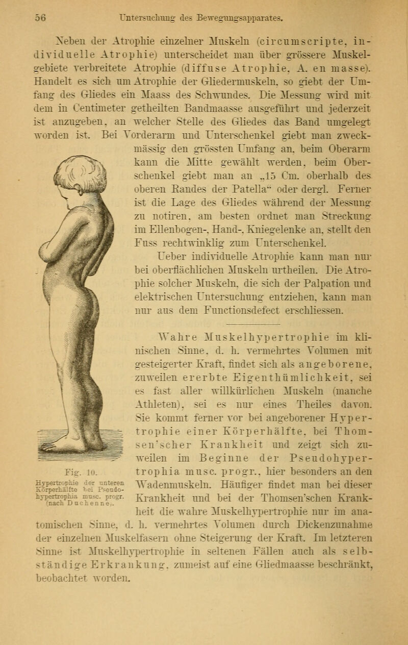 Neben der Atrophie einzelner Muskeln (circumscripta, in- dividuelle Atrophie) unterscheidet man über grössere Muskel- Gebiete verbreitete Atrophie (diffuse Atrophie. A. en masse). Handelt es sich um Atrophie der Giiederniuskeln. so giebt der Um- fang des Gliedes ein Maass des Schwundes. Die Messung- wird mit dem in Centimeter getheilten Bandmaasse ausgeführt und jederzeit ist anzugeben, an welcher Stelle des Gliedes das Band umgelegt worden ist. Bei Torderarm und Unterschenkel giebt man zweck- mässig den grössten Umfang an beim Oberarm kann die Mitte gewählt werden, beim Ober- schenkel giebt man an „15 Cm. oberhalb des oberen Eandes der Patella oder dergl. Ferner ist die Lage des Gliedes während der Messung zu notiren. am besten ordnet man Streckung im Ellenbogen-. Hand-. Kniegelenke an. stellt den Fnss rechtwinklig zum Unterschenkel. Ueber individuelle Atrophie kann man nur bei oberflächlichen Muskeln urtheilen. Die Atro- phie solcher Muskeln, die sich der Palpation und elektrischen Untersuchung entziehen, kann man nur aus dem Functionsdefect erschliessen. Wahre Muskelhypertrophie im kli- nischen Sinne, d. h. vermehrtes Volumen mit gesteigener Kraft, findet sich als angeborene, zuweilen ererbte Eigenthümlichkeit. <ei es fast aller willkürlichen Muskeln ('manche AthleteD . sei es nur eines Theiles davon. Sie kommt ferner vor bei angeborener Hyper- trophie einer Körperhälfte, bei Thom- 'seber Krankheit und zeigt sich zu- weilen im Beginne der Pseudohyper- trophia musc. progr.. liier besonders an den Wadenmuskeln. Häufiger findet man bei dieser Krankkeit und bei der Thomsen'schen Krank- heit die wahre Muskelhypertrophie nur im ana- - -lieii Sinne, d. h. vermeintes Volumen durch Dickenzunahme einzelnen Muskelfasern ohne Steigerung der Kraft. Im letzt Sinne ist Mnskelhypertrophie in seltenen Fällen auch als selb- ständige Erkrankung, zumeist auf eine Gliedmaasse beschränkt, beobachtet worden. 10. :.: :. -J=endo- hypertrophia musc. progr. eh Ducken: