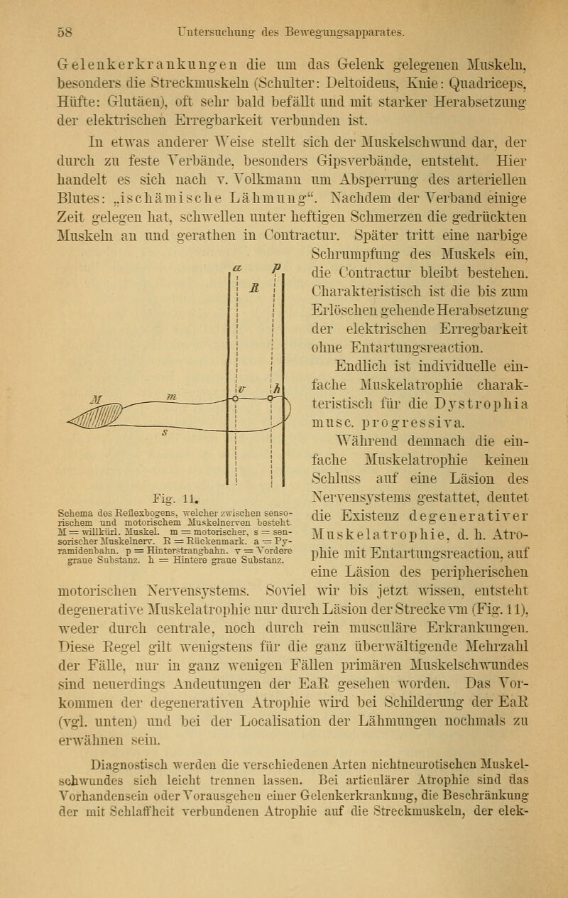 Gelenkerkrankungen die um das Gelenk gelegenen Muskeln, besonders die Streckmuskeln (Schulter: Deltoideus. Knie: Quadriceps. Hüfte: Glutäen). oft sehr bald befällt und mit starker Herabsetzung der elektrischen Erregbarkeit verbunden ist. In etwas anderer Weise stellt sich der Muskelschwund dar, der durch zu feste Verbände, besonders Gipsverbände, entsteht. Hier handelt es sich nach v. Volkniann um Absperrung des arteriellen Blutes: ,.ischämische Lähmung. Nachdem der Verband einige Zeit gelegen hat, schwellen unter heftigen Schmerzen die gedrückten Muskeln an und gerathen in Contractur. Später tritt eine narbige Schrumpfung des Muskels ein. die Contractur bleibt bestehen. Charakteristisch ist die bis zum Erlöschen gehende Herabsetzung der elektrischen Erregbarkeit ohne Entartungsreaction. Endlich ist individuelle ein- fache Muskelatrophie charak- teristisch für die Dystrophia musc. progressiva. Während demnach die ein- fache Muskelatrophie keinen Schluss auf eine Läsion des Nervensystems gestattet, deutet die Existenz degenerativer Muskelatrophie, d. h. Atro- phie mit Entartungsreaction. auf eine Läsion des peripherischen motorischen Xervens3Tstems. Soviel vir bis jetzt wissen, entsteht degenerative Muskelatrophie nur durch Läsion der Strecke vm (Fig. 11). weder durch centrale, noch durch rein musculäre Erkrankungen. Diese Eegel gilt wenigstens für die ganz überwältigende Mehrzahl der Fälle, nur in ganz wenigen Fällen primären Muskelschwundes sind neuerdings Andeutungen der EaE gesehen worden. Das Vor- kommen der degenerativen Atrophie wird bei Schilderung der EaE (vgl. unten) und bei der Localisation der Lähmungen nochmals zu erwähnen sein. Diagnostisch werden die verschiedenen Arten nichtnenrotischen Muskel- schwundes sich leicht trennen lassen. Bei articulärer Atrophie sind das Vorhandensein oder Vorausgehen einer Gelenkerkranknng, die Beschränkung der mit Schlaffheit verbundenen Atrophie auf die Streckmuskeln, der elek- Fig. 11. Schema des Reflexbogens, -welcher zwischen senso- rischem und motorischem Muskelnerven besteht. M = 'willkürl. iluskel. m = motorischer, s = sen- sorischer lluskelnerr. R = Rückenmark, a — Py- ramidenbahn. p = Hinterstrangbahn, v = Vordere graue Substanz, h = Hintere graue Substanz.