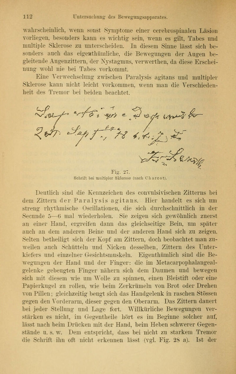 wahrscheinlich, wenn sonst Symptome einer cerebrospinalen Läsion vorliegen, besonders kann es wichtig sein, wenn es gilt. Tabes und multiple Sklerose zu unterscheiden. In diesem Sinne lässt sich be- sonders auch das eigentümliche, die Bewegungen der Augen be- gleitende Augenzittern, der Nystagmus, verwerthen. da diese Erschei- nung wohl nie bei Tabes vorkommt. Eine Verwechselung zwischen Paralysis agitans und multipler Sklerose kann nicht leicht vorkommen, wenn man die Verschieden- heit des Tremor bei beiden beachtet. Fig. 27. Schrift bei multipler Sklerose (nach Charcot). Deutlich sind die Kennzeichen des convulsivischen Zitterns bei dem Zittern der Paralysis agitans. Hier handelt es sich um streng rhythmische Oscillationen. die sich durchschnittlich in der Secunde 5—6 mal wiederholen. Sie zeigen sich gewöhnlich zuerst an einer Hand, ergreifen dann das gleichseitige Bein, um später auch an dem anderen Beine und der anderen Hand sich zu zeigen. Selten betheiligt sich der Kopf am Zittern, doch beobachtet man zu- weilen auch Schütteln und Nicken desselben. Zittern des Unter- kiefers und einzelner Gesichtsmuskeln. Eigentümlich sind die Be- wegungen der Hand und der Finger: die im Metacarpophalangeal- gelenke gebeugten Finger nähern sich dem Daumen und bewegen sich mit diesem wie um AVoile zu spinnen, einen Bleistift oder eine Papierkugel zu rollen, wie beim Zerkrümeln von Brot oder Drehen von Pillen: gleichzeitig beugt sich das Handgelenk in raschen Stössen gegen den Vorderarm, dieser gegen den Oberarm. Das Zittern dauert bei jeder Stellung und Lage fort. Willkürliche Bewegungen ver- stärken es nicht, im Gegentheile hört es im Beginne solcher auf. äsl nach beim Drücken mit der Hand, beim Heben schwerer Gegen- stände u. s. w. Dem entspricht, dass bei nicht zu starkem Tremor die Schrift ihn oft nicht erkennen lässt (vgl. Fig. 25 a). Ist der