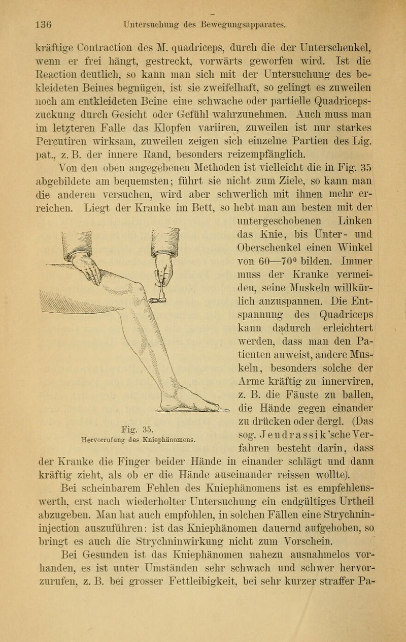 kräftige Coiitraction des M. quadriceps, durch die der Unterschenkel, wenn er frei hängt, gestreckt, vorwärts geworfen wird. Ist die Keaction deutlieh, so kann man sich mit der Untersuchung des be- kleideten Beines begnügen, ist sie zweifelhaft, so gelingt es zuweilen noch am entkleideten Beine eine schwache oder partielle Quadriceps- znckimg durch Gesicht oder Gefühl wahrzunehmen. Auch muss man im letzteren Falle das Klopfen variiren, zuweilen ist nur starkes Percutiren wirksam, zuweilen zeigen sich einzelne Partien des Lig. pat, z.B. der innere Eand, besonders reizempfänglich. Von den oben angegebenen Methoden ist vielleicht die in Fig. 35 abgebildete am bequemsten; führt sie nicht zum Ziele, so kann man die anderen versuchen, wird aber schwerlich mit ihnen mehr er- reichen. Liegt der Kranke im Bett, so hebt man am besten mit der untergeschob enen Linken das Knie, bis Unter- und Oberschenkel einen Winkel von 60—70° bilden. Immer muss der Kranke vermei- den, seine Muskeln willkür- lich anzuspannen. Die Ent- spannung des Quadriceps kann dadurch erleichtert werden, dass man den Pa- tienten anweist, andere Mus- keln, besonders solche der Arme kräftig zu innerviren, z. B. die Fäuste zu ballen, die Hände gegen einander zu drücken oder dergl. (Das sog. Jendrassik'seheVer- fahren besteht darin, dass der Kranke die Finger beider Hände in einander schlägt und dann kräftig zieht, als ob er die Hände auseinander reissen wollte). Bei scheinbarem Fehlen des Kniephänomens ist es empfehlens- werth, erst nach wiederholter Untersuchung ein endgültiges Urtheil abzugeben. Man hat auch empfohlen, in solchen Fällen eine Strychnin- injeetion auszuführen: ist das Kniephänomen dauernd aufgehoben, so bringt es auch die Strychninwirkimg nicht zum Vorschein. Bei Gesunden ist das Kniephänomen nahezu ausnahmelos vor- handen, es ist unter Umständen sehr schwach und schwer hervor- zurufen, z. B. bei grosser Fettleibigkeit, bei sehr kurzer straffer Pa- Fig. 35. Herrorrufung des Kniephänomens.