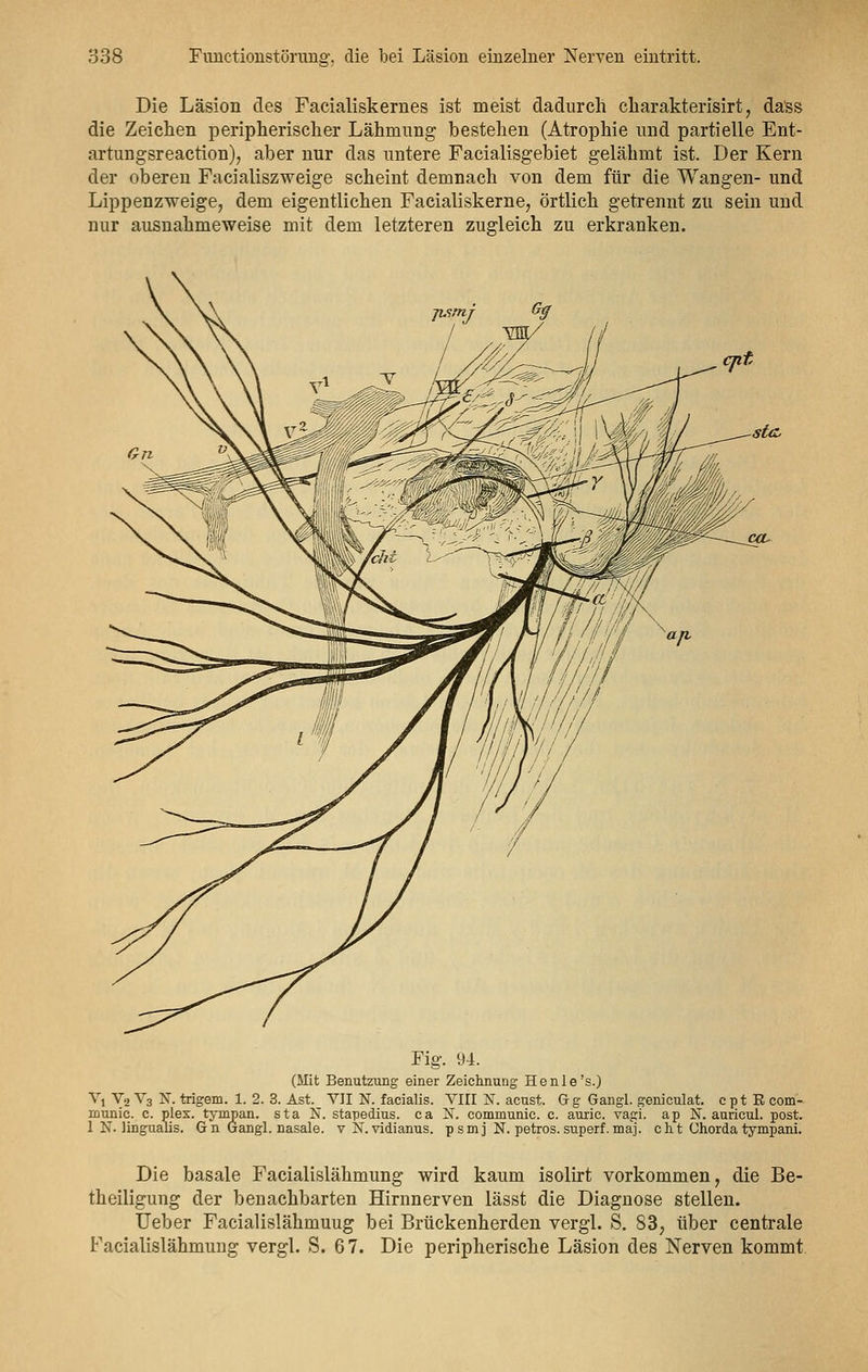 Die Läsion des Facialiskernes ist meist dadurch charakterisirt, da'ss die Zeichen peripherischer Lähmung bestehen (Atrophie und partielle Ent- artungsreaction), aber nur das untere Facialisgebiet gelähmt ist. Der Kern der oberen Facialiszweige scheint demnach von dem für die Wangen- und Lippenzweige, dem eigentlichen Facialiskerne, örtlich getrennt zu sein und nur ausnahmeweise mit dem letzteren zugleich zu erkranken. jismj G$ st(t ca. Fig. 94. (Mit Benutzung einer Zeichnung Henle's.) Vj V2 V3 KT. trigem. 1. 2. 3. Ast. VII N. facialis. VIII N. acust. G g Gangl. geniculat. c p t R com- rounie. c. plex. tympan. sta N. stapedius. ca N. communic. c. auric. vagi. ap N. auricul. post. 1 N. lingualis. G n Gangl. nasale, v N. vidianus. psmj N. petros. superf. maj. c h t Chorda tympani. Die basale Facialislähmung wird kaum isolirt vorkommen, die Be- theiligung der benachbarten Hirnnerven lässt die Diagnose stellen. Ueber Facialislähmuug bei Brückenherden vergl. S. 83, über centrale Facialislähmung vergl. S. 67. Die peripherische Läsion des Nerven kommt