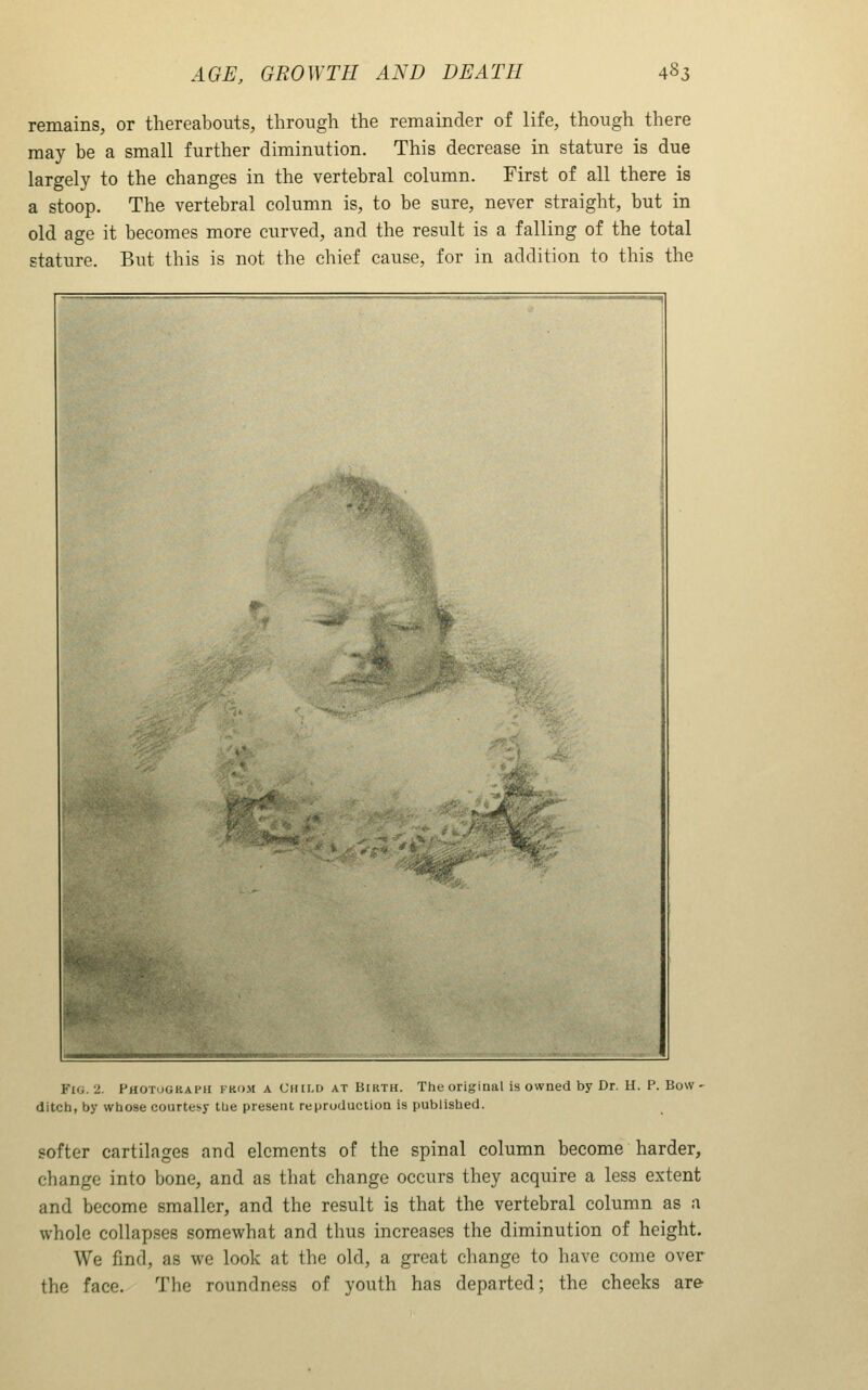 remains, or thereabouts, through the remainder of life, though there may be a small further diminution. This decrease in stature is due largely to the changes in the vertebral column. First of all there is a stoop. The vertebral column is, to be sure, never straight, but in old age it becomes more curved, and the result is a falling of the total stature. But this is not the chief cause, for in addition to this the Fig. 2. Photugkaph fkom a Ciiii-d at Birth. The original is owned by Dr. H. P. Bow- ditch, by whose courtesy tlie present reproduction is published. softer cartilages and elements of the spinal column become harder, change into bone, and as that change occurs they acquire a less extent and become smaller, and the result is that the vertebral column as a whole collapses somewhat and thus increases the diminution of height. We find, as we look at the old, a great change to have come over the face. The roundness of youth has departed; the cheeks are