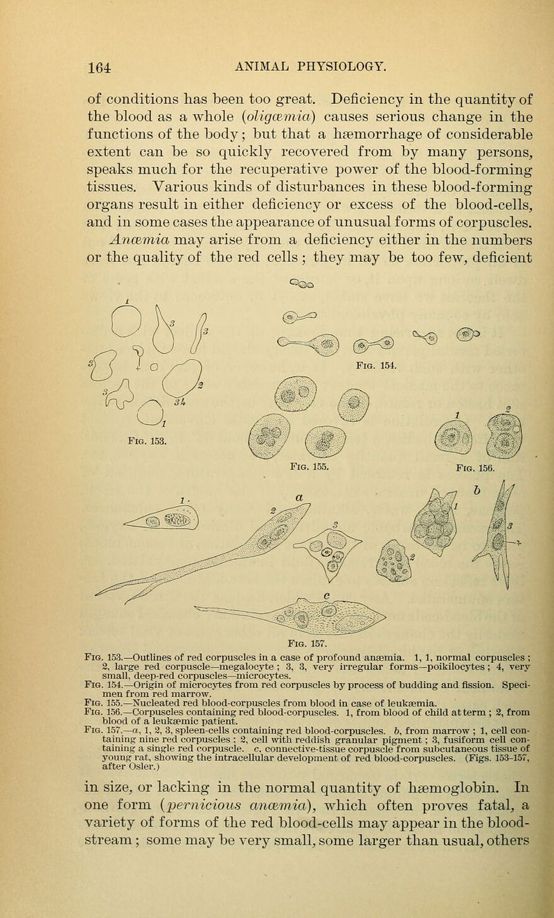 of conditions has been too great. Deficiency in the quantity of the blood as a whole {oligcemia) causes serious change in the functions of the body; but that a haemorrhage of considerable extent can be so quickly recovered from by many persons, speaks much for the recuperative power of the blood-forming tissues. Various kinds of disturbances in these blood-forming organs result in either deficiency or excess of the blood-cells, and in some cases the appearance of unusual forms of corpuscles. AncBmia may arise from a deficiency either in the numbers or the quality of the red cells ; they may be too few, deficient Fig. 157. Fig. 153.—Outlines of red corpuscles in a case of profound ansemia. 1, 1, normal corpuscles ; 2, large red corpuscle—megalocyte ; 3, 3, very irregular forms—poikilocytes ; 4, very small, deep-red corpuscles—microcytes. Fig. 154.—Origin of microcytes from red corpuscles by process of budding and fission. Speci- men from red marrow. Fig. 155.—Nucleated red blood-corpuscles from blood in case of leukaemia. Fig. 156.—Corpuscles containing red blood-corpuscles. 1, from blood of child at term ; 2, from blood of a leuksemic patient. Fig. 157.—a, 1, 2, 3, spleen-cells containing red blood-corpuscles. 6, from marrow ; 1, ceU con- taining nine red corpuscles ; 2, cell with reddish granular pigment; 3, fusiform cell con- taining a single red corpuscle, c, connective-tissue corpuscle from subcutaneous tissue of young rat, showing the intracellular development of red blood-corpuscles. (Figs. 15:3-157, after Osier.) in size, or lacking in the normal quantity of haemoglobin. In one form {pernicious ancBmia), which often proves fatal, a variety of forms of the red blood-cells may appear in the blood- stream ; some may be very small, some larger than usual, others