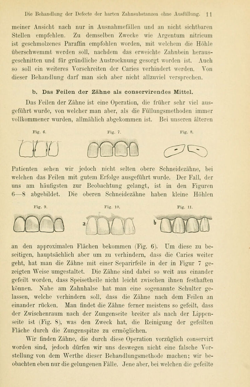 meiner Ansicht nach nur in AusnalinicfäUcn und au nicht sichtbaren Stellen empfehlen. Zu (lenisell)en Zwecke wie Arfrentum nitricum ist geschmolzenes Paraflin empfohlen worden, mit welchem die Höhle überschwemmt werden soll, nachdem das erweichte Zahnbein heraus- geschnitten und für gründliche Anstrocknung gesorgt worden ist. Auch so soll ein weiteres Vorsclireiten der Caries verhindert werden. Von dieser Behandlung darf man sich aber nicht allzuviel versprechen. b. Das Feilen der Zähne als conservirendes Mittel. Das Feilen der Zähne ist eine Operation, die früher sehr viel aus- geführt wurde, von welcher man aber, als die Füllungsmethoden immer vollkommener wurden, allmählich abgekommen ist. Bei unseren älteren Fig. 6. Fig. 7. Fig. 8. Patienten sehen wir jedoch nicht selten obere Schneidezähne, bei welchen das Feilen mit gutem Erfolge ausgeführt wurde. Der Fall, der uns am häufigsten zur Beobachtung gelangt, ist in den Figuren 6—8 abgebildet. Die oberen Schneidezähne haben kleine Höhlen Fig. 9. Fig. 10. Fig. 11. an den approximalen Flächen bekommen (Fig. 6). Um diese zu be- seitigen, hauptsächlich aber um zu verhindern, dass die Caries weiter geht, hat man die Zähne mit einer Separirfeile in der in Figiu- 7 ge- zeigten Weise umgestaltet. Die Zähne sind dabei so weit aus einander gefeilt worden, dass Speisetheile nicht leicht zwischen ihnen festhaften können. Nahe am Zahnhalse hat man eine sogenannte Schulter ge- lassen, welche verhindern soll, dass die Zähne nach dem Feilen an einander rücken. Man findet die Zähne ferner meistens so gefeilt, dass der Zwischenraum nach der Zimgenseite breiter als nach der Lippen- seite ist (Fig. 8), was den Zweck hat, die Reinigung der gefeilten Fläche durch die Zungenspitze zu ermöglichen. Wir finden Zähne, die durch diese Operation vorzüglich conservirt worden sind, jedoch dürfen wir uns deswegen nicht eine falsche Vor- stellung von dem Werthe dieser Behandlungsmethode machen; wir be- obachten eben nur die gelungenen Fälle. Jene aber, bei welchen die gefeilte