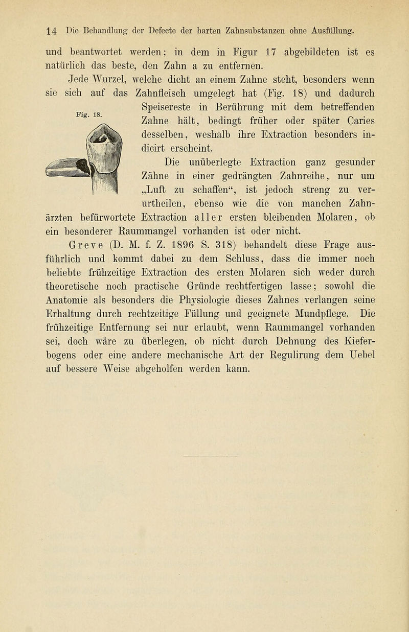 und beantwortet werden; in dem in Figur 17 abgebildeten ist es natürlich das beste, den Zahn a zu entfernen. Jede Wurzel, welche dicht an einem Zahne steht, besonders wenn sie sich auf das Zahnfleisch umgelegt hat (Fig. 18) und dadurch Speisereste in Berührung mit dem betreffenden Fig. 18. Zahne hält, bedingt früher oder später Caries desselben, weshalb ihre Extraction besonders in- dicirt erscheint. Die unüberlegte Extraction ganz gesunder Zähne in einer gedrängten Zahnreihe, nur um „Luft zu schaffen, ist jedoch streng zu ver- urtheilen, ebenso wie die von manchen Zahn- ärzten befürwortete Extraction aller ersten bleibenden Molaren, ob ein besonderer Raummangel vorhanden ist oder nicht. Greve (D. M. f. Z. 1896 S. 318) behandelt diese Frage aus- führlich und kommt dabei zu dem Schluss, dass die immer noch beliebte frühzeitige Extraction des ersten Molaren sich weder durch theoretische noch practische Gründe rechtfertigen lasse; sowohl die Anatomie als besonders die Physiologie dieses Zahnes verlangen seine Erhaltung durch rechtzeitige Füllung und geeignete Mundpflege. Die frühzeitige Entfernung sei nur erlaubt, wenn Raummangel vorhanden sei, doch wäre zu überlegen, ob nicht durch Dehnung des Eäefer- bogens oder eine andere mechanische Art der Reguhrung dem Uebel auf bessere Weise absreholfen werden kann.