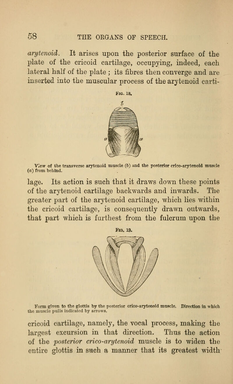 arytenoid. It arises upon the posterior surface of the plate of the cricoid cartilage, occupying, indeed, each lateral half of the plate ; its fibres then converge and are inserted into the muscular process of the arytenoid carti- Vlew of the transverse arytenoid muscle (6) and the posterior crico-arytenoid muscle (a) from behind. lage. Its action is such that it draws down these points of the arytenoid cartilage backwards and inwards. The greater part of the arytenoid cartilage, which lies within the cricoid cartilage, is consequently drawn outwards, that part which is farthest from the fulcrum upon the ¥ia. 19. Form given to the glottis by the posterior crico-arytenoid muscle. Direction in which the muscle pulls indicated by arrows. cricoid cartilage, namely, the vocal process, making the largest excursion in that direction. Thus the action of the posterior crico-arytenoid muscle is to widen the entire glottis in such a manner that its greatest width