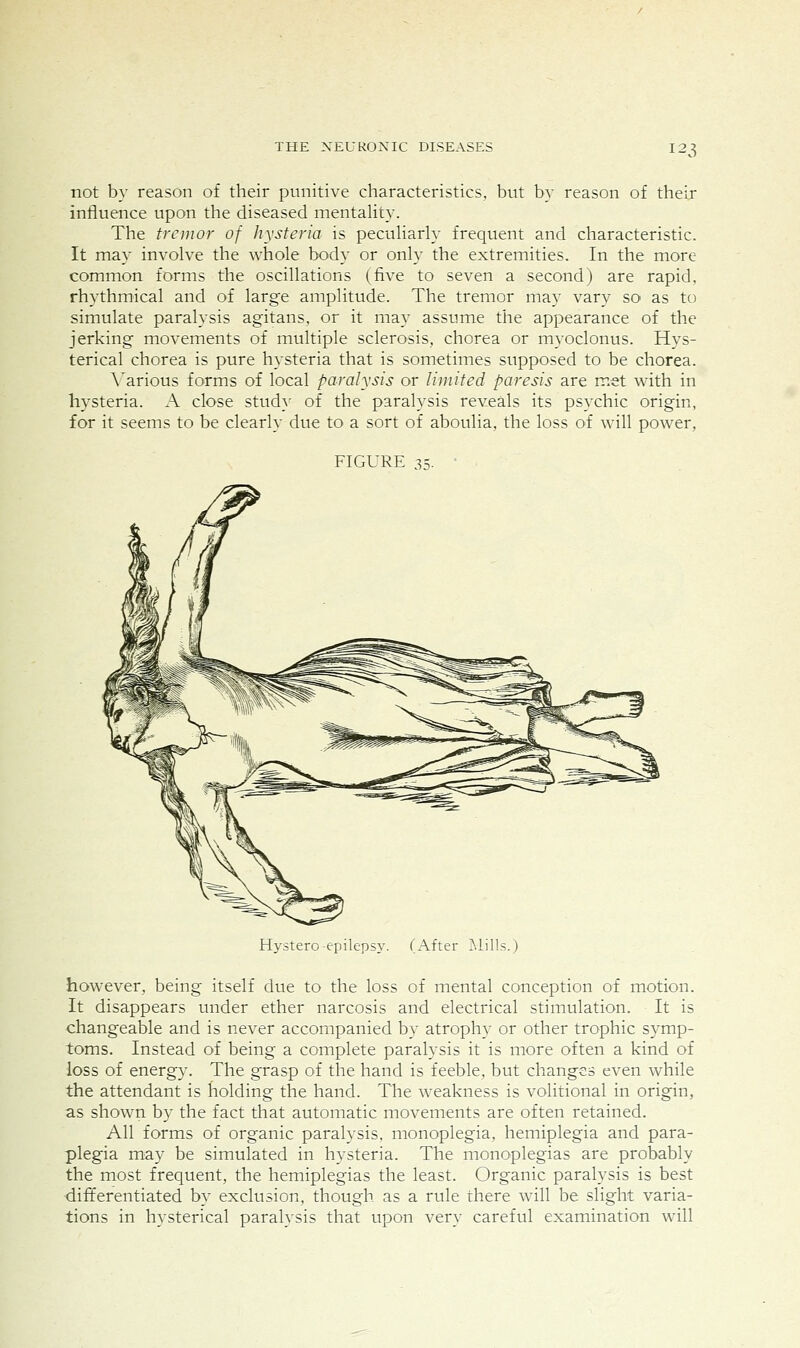 not by reason of their punitive characteristics, but by reason of their influence upon the diseased mentality. The tremor of hysteria is pecuharly frequent and characteristic. It may involve the whole body or only the extremities. In the more common forms the oscillations (five to seven a second) are rapid, rhythmical and of large amplitude. The tremor may vary so as to simulate paralysis agitans, or it may assume the appearance of the jerking movements of multiple sclerosis, chorea or myoclonus. Hys- terical chorea is pure hysteria that is sometimes supposed to be chorea. A'arious forms of local paralysis or limited paresis are met with in hysteria. A close stud}' of the paralysis reveals its psychic origin, for it seems to be clearly due to a sort of aboulia, the loss of will power, FIGURE 35. Hystero-epilepsy. (After Mills.) however, being itself due to the loss of mental conception of motion. It disappears under ether narcosis and electrical stimulation. It is changeable and is never accompanied by atrophy or other trophic symp- toms. Instead of being a complete paralysis it is more often a kind of loss of energ3^ The grasp of the hand is feeble, but changes even while the attendant is holding the hand. The weakness is volitional in origin, as shown by the fact that automatic movements are often retained. All forms of organic paralysis, monoplegia, hemiplegia and para- plegia may be simulated in hysteria. The monoplegias are probably the most frequent, the hemiplegias the least. Organic paralysis is best differentiated by exclusion, though as a rule there will be slight varia- tions in hysterical paralysis that upon very careful examination will