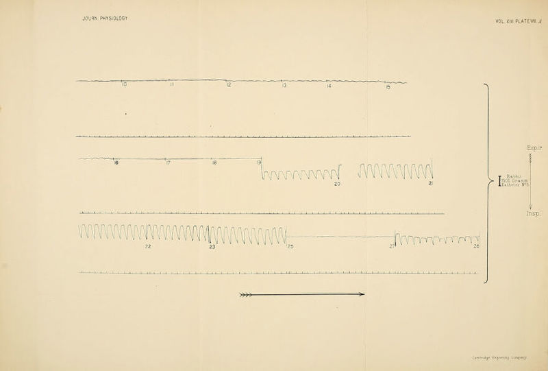 VOL, XIII PLATEVIII.J nf^r^rrnri I I I 1 I I L, Expir. >l Rabbit 1500 GroLmm Kitheter N?5 Insp. »»■